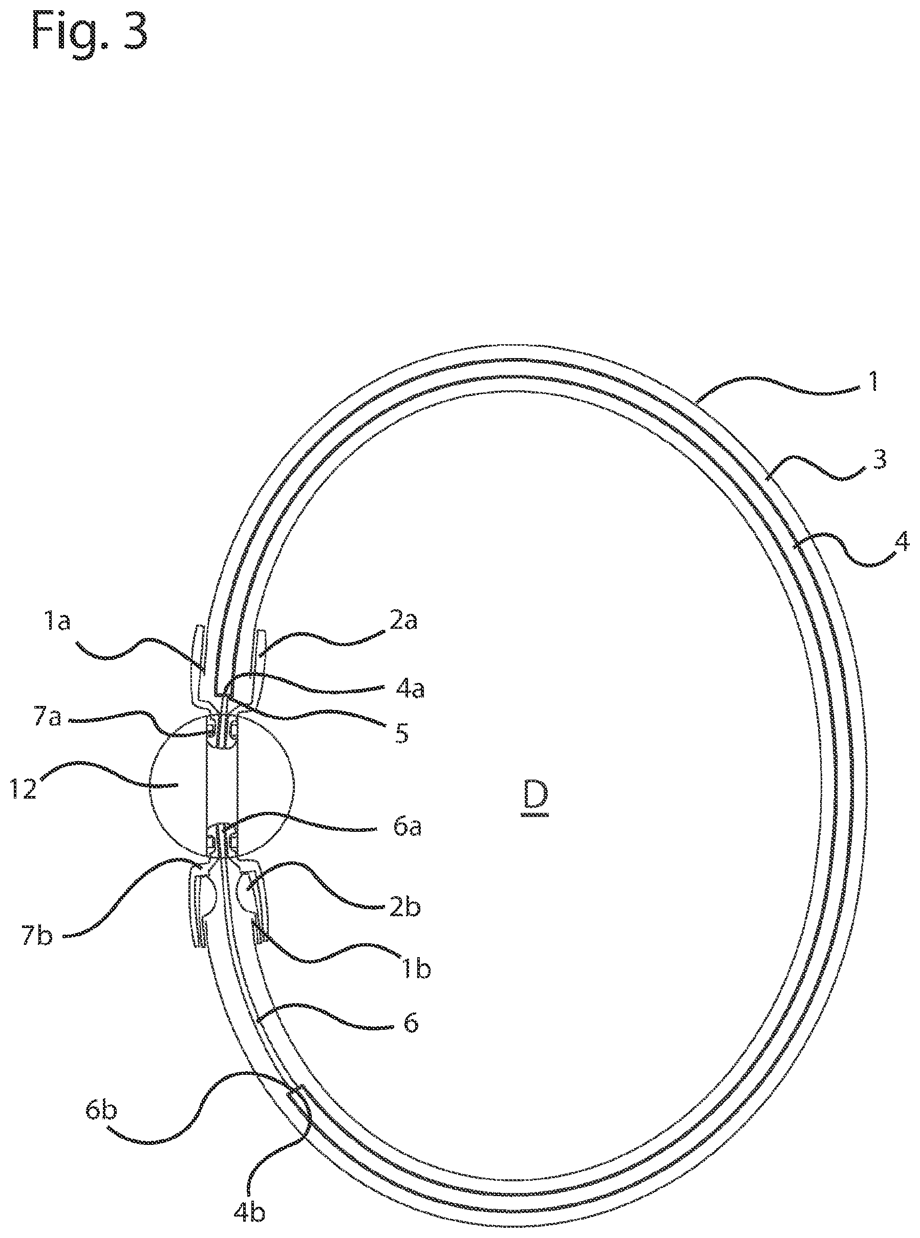 Patent US12396527 Figure 3 – Jewelry piece