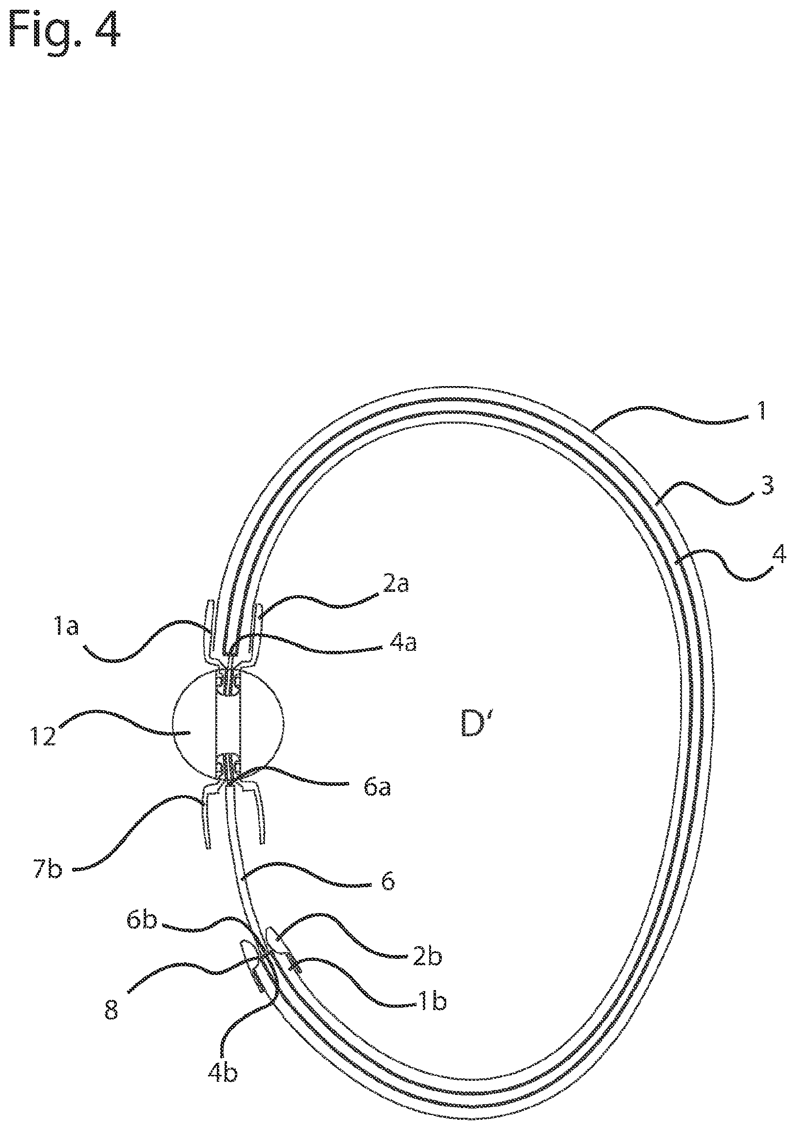 Patent US12396527 Figure 4 – Jewelry piece