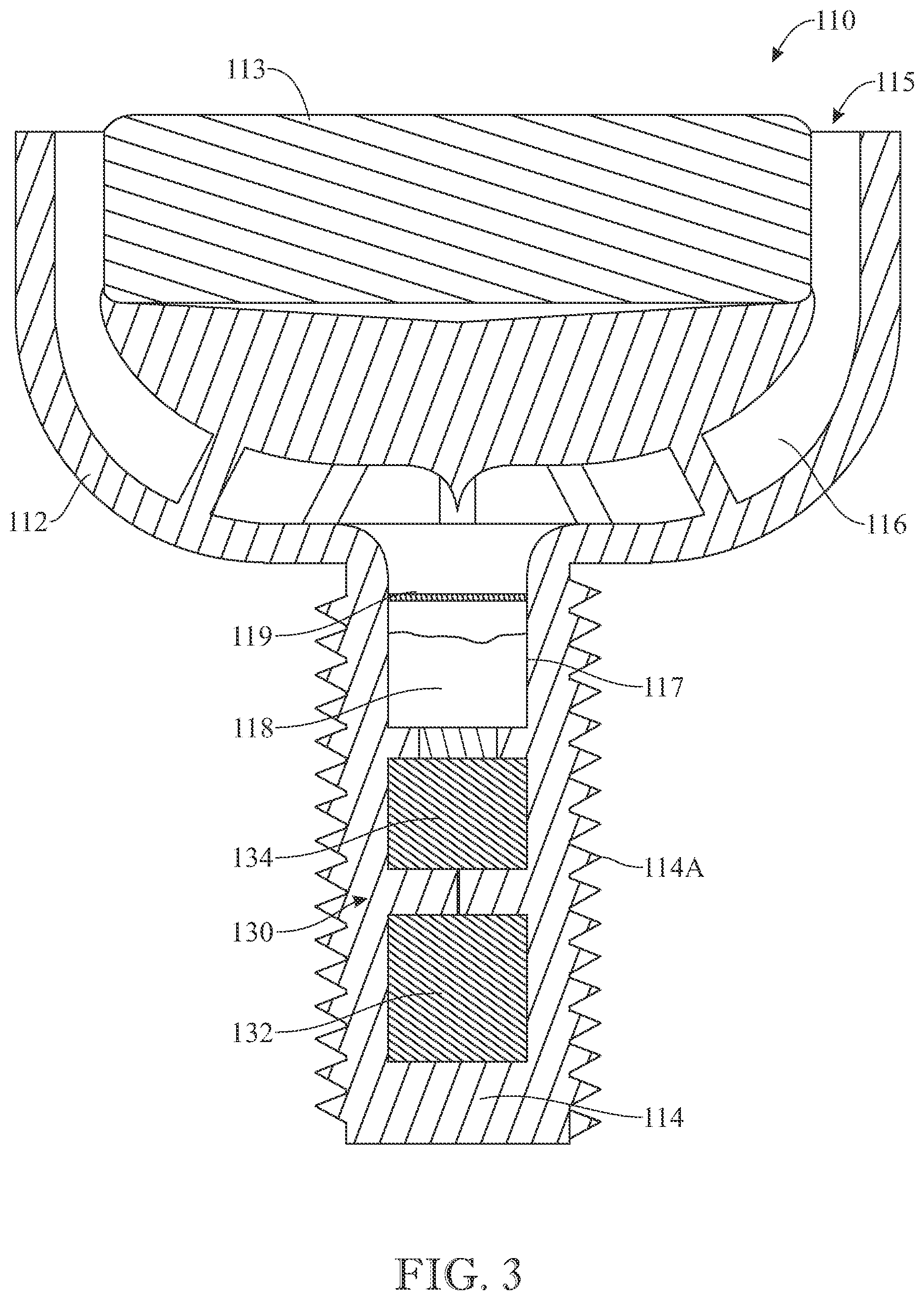 Patent US12396528 Figure 3 – Tamper-proof wearable device and system thereof