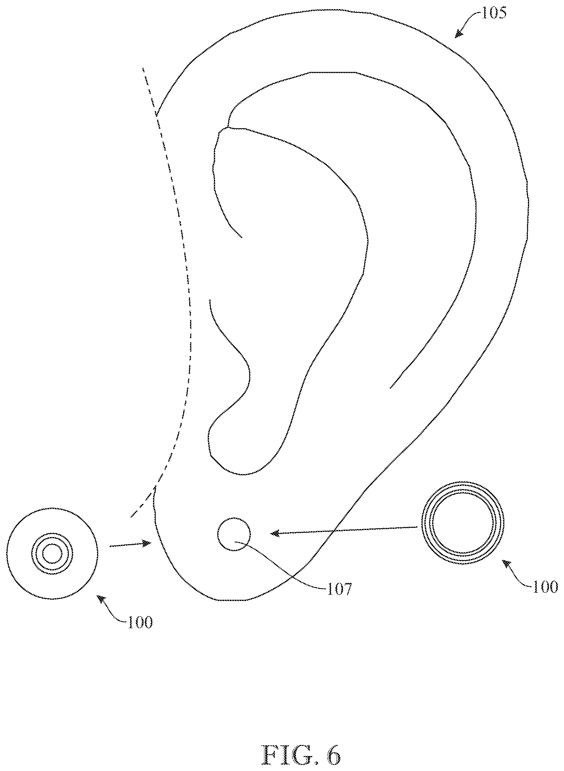 Patent US12396528 Figure 6 – Tamper-proof wearable device and system thereof