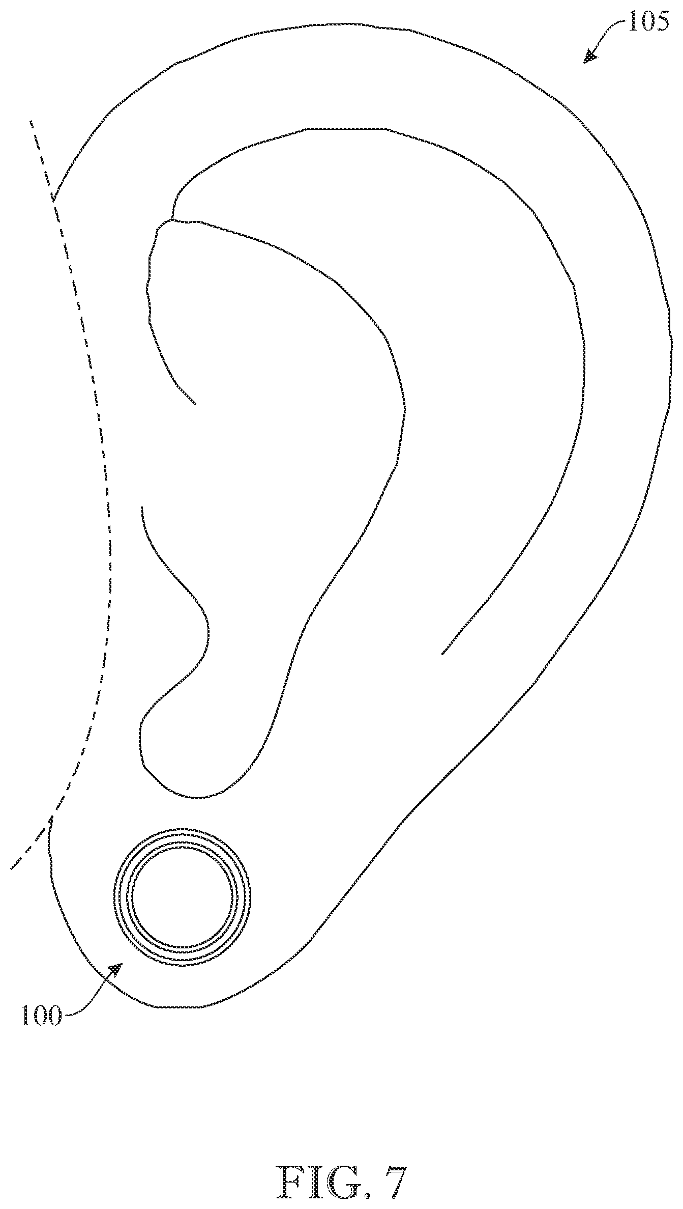 Patent US12396528 Figure 7 – Tamper-proof wearable device and system thereof