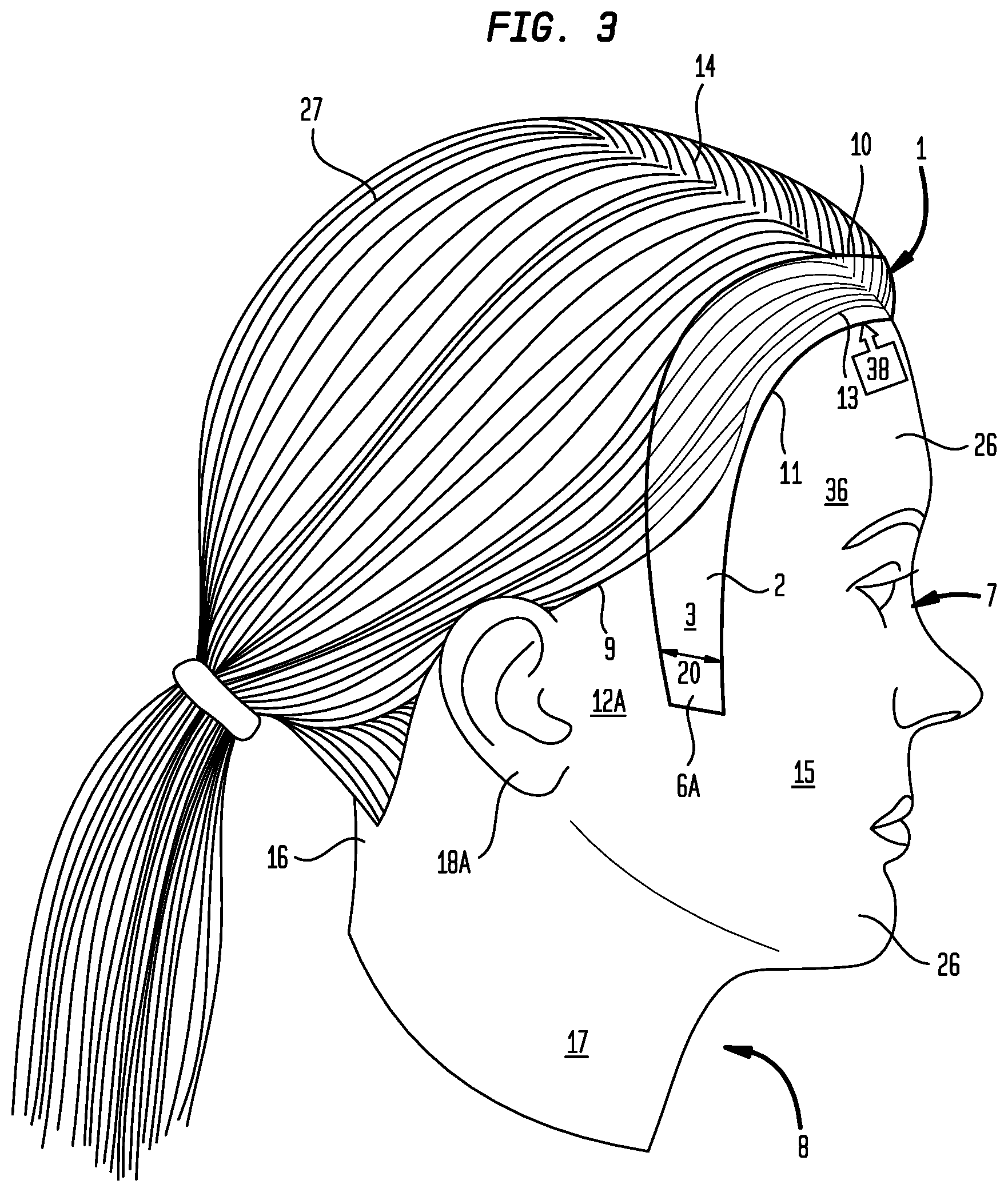 Patent US12396540 Figure 3 – Hair treatment system