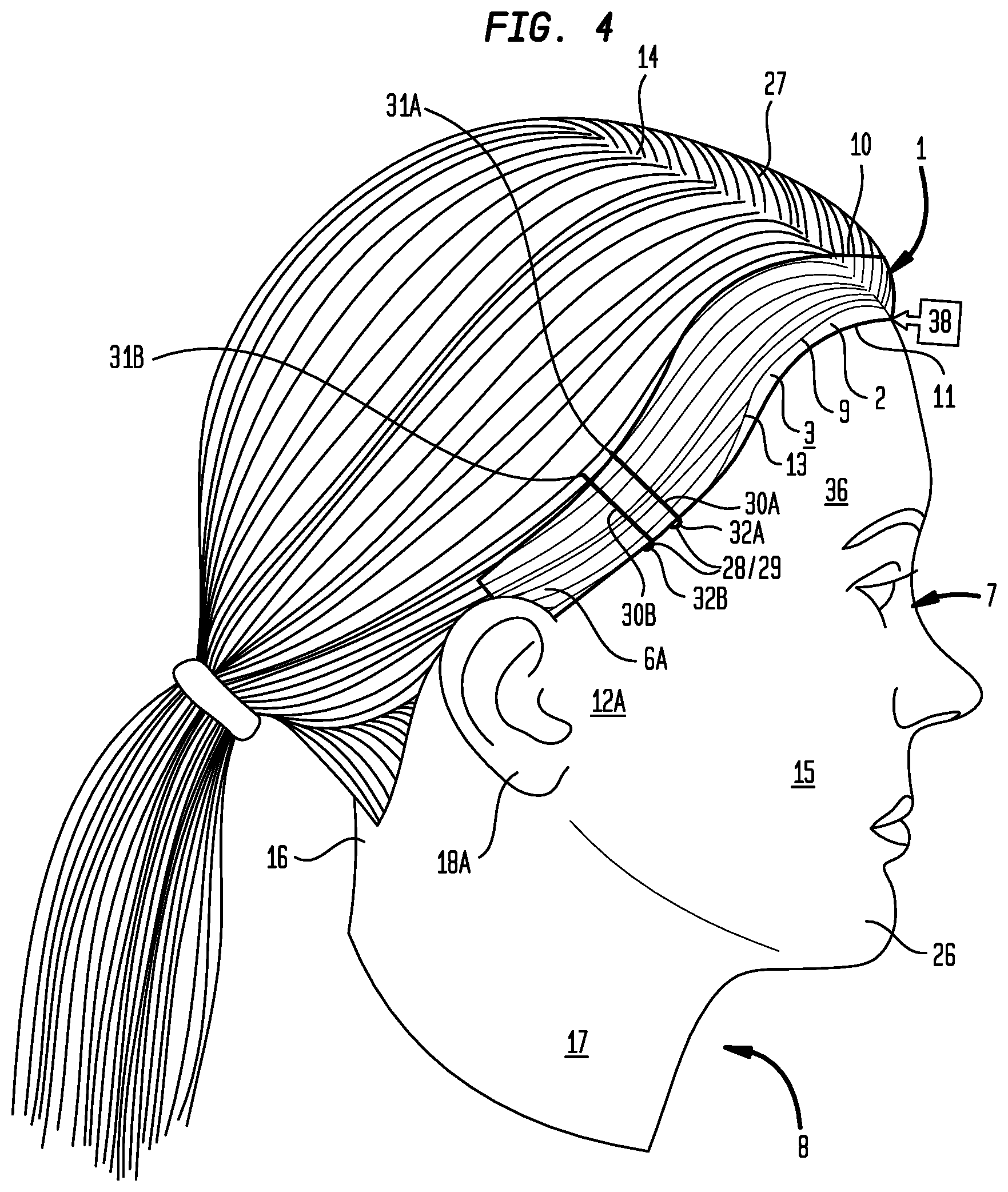 Patent US12396540 Figure 4 – Hair treatment system