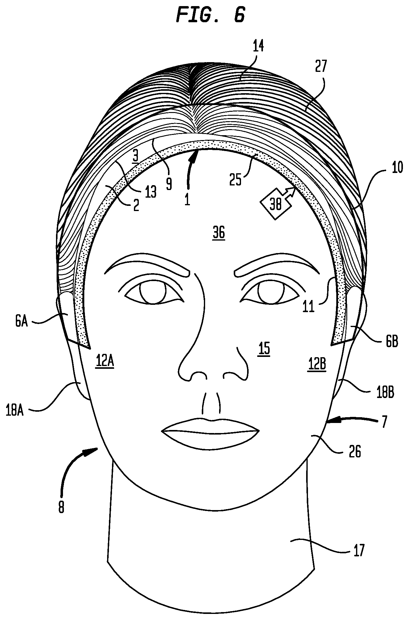 Patent US12396540 Figure 6 – Hair treatment system