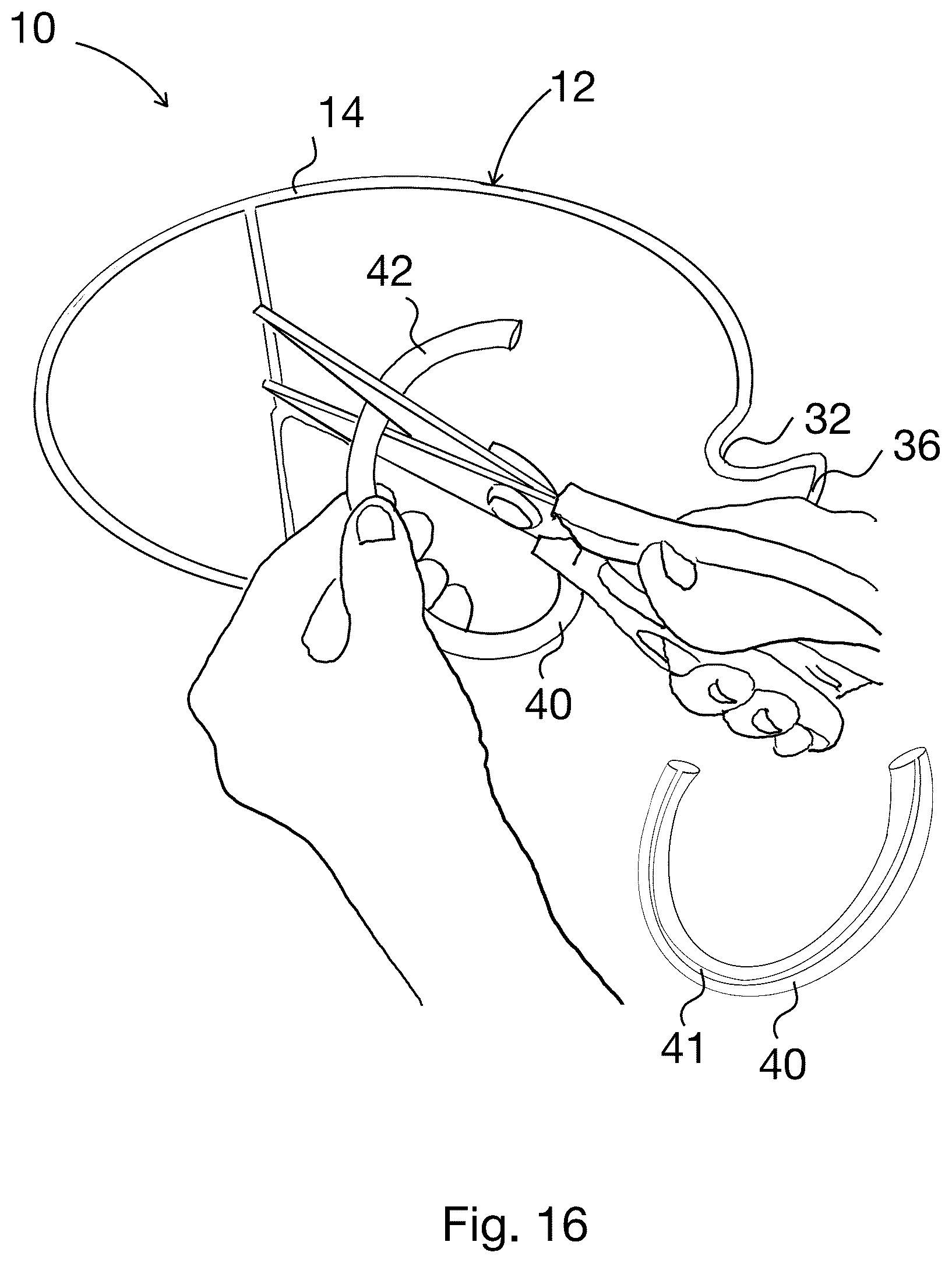Patent US12396578 Figure 16 – Display clips