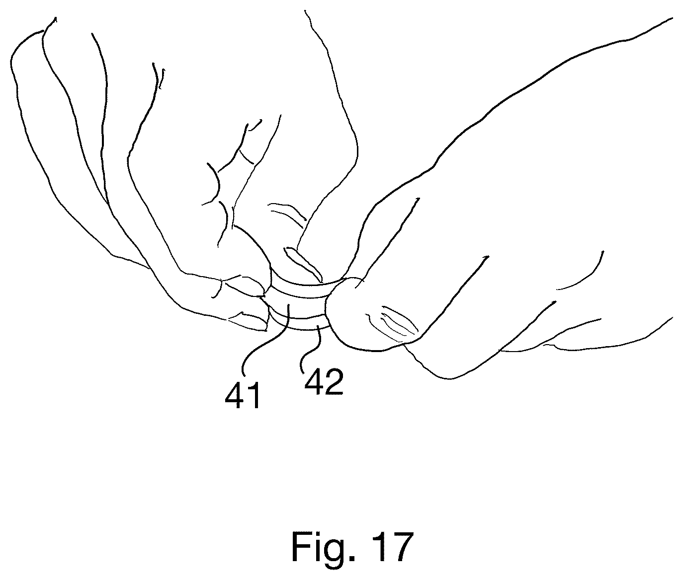 Patent US12396578 Figure 17 – Display clips