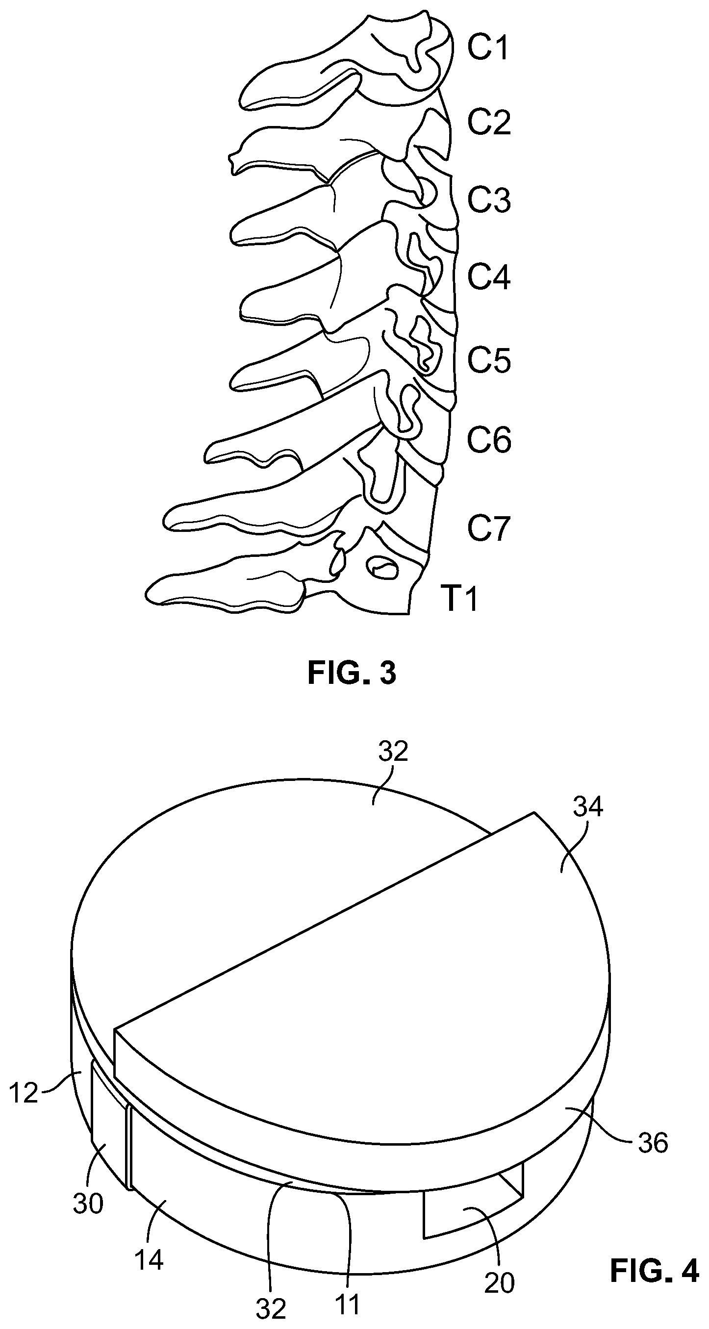 Patent US12396580 Figure 6 – Neck support