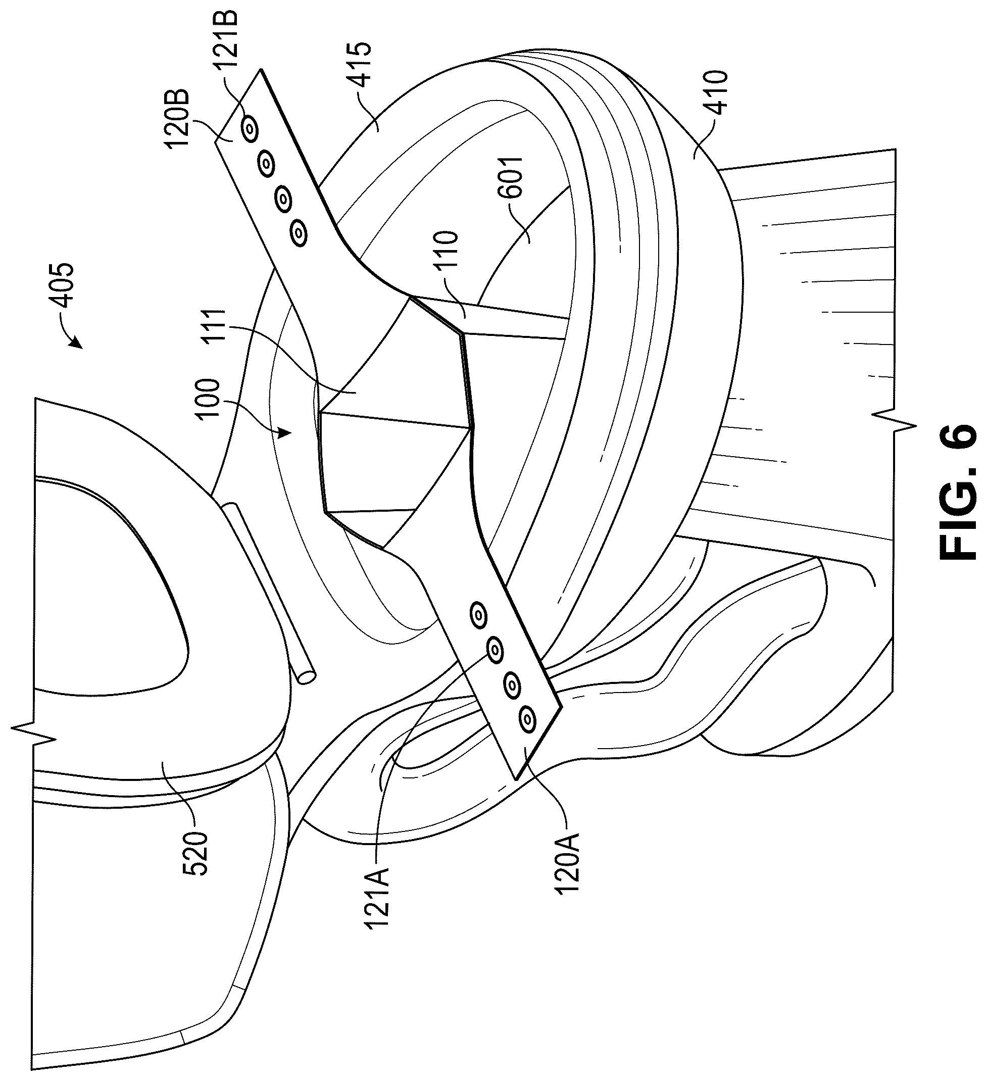 Patent US12396601 Figure 13 – Toilet shield