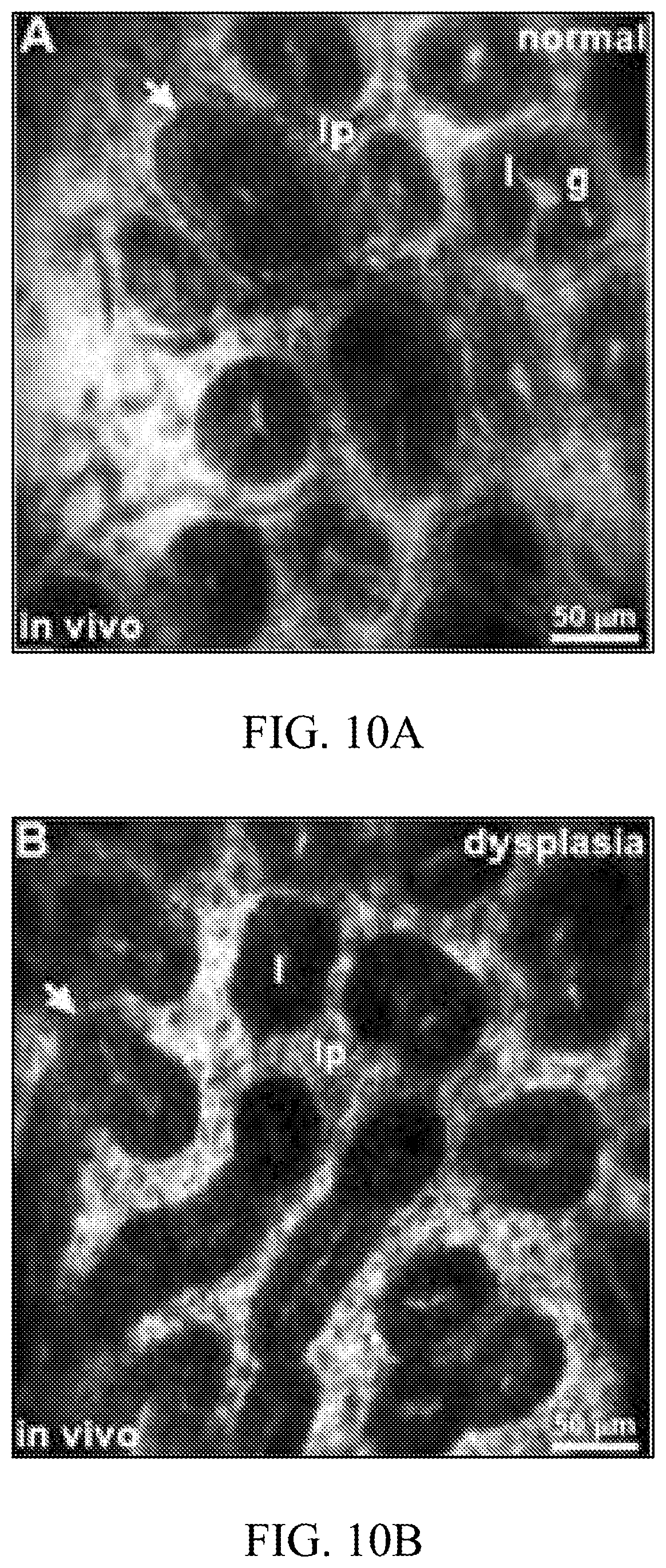 Patent US12396625 Figure 13 – Ultra-compact microsystems-based single axis confocal endomicroscope