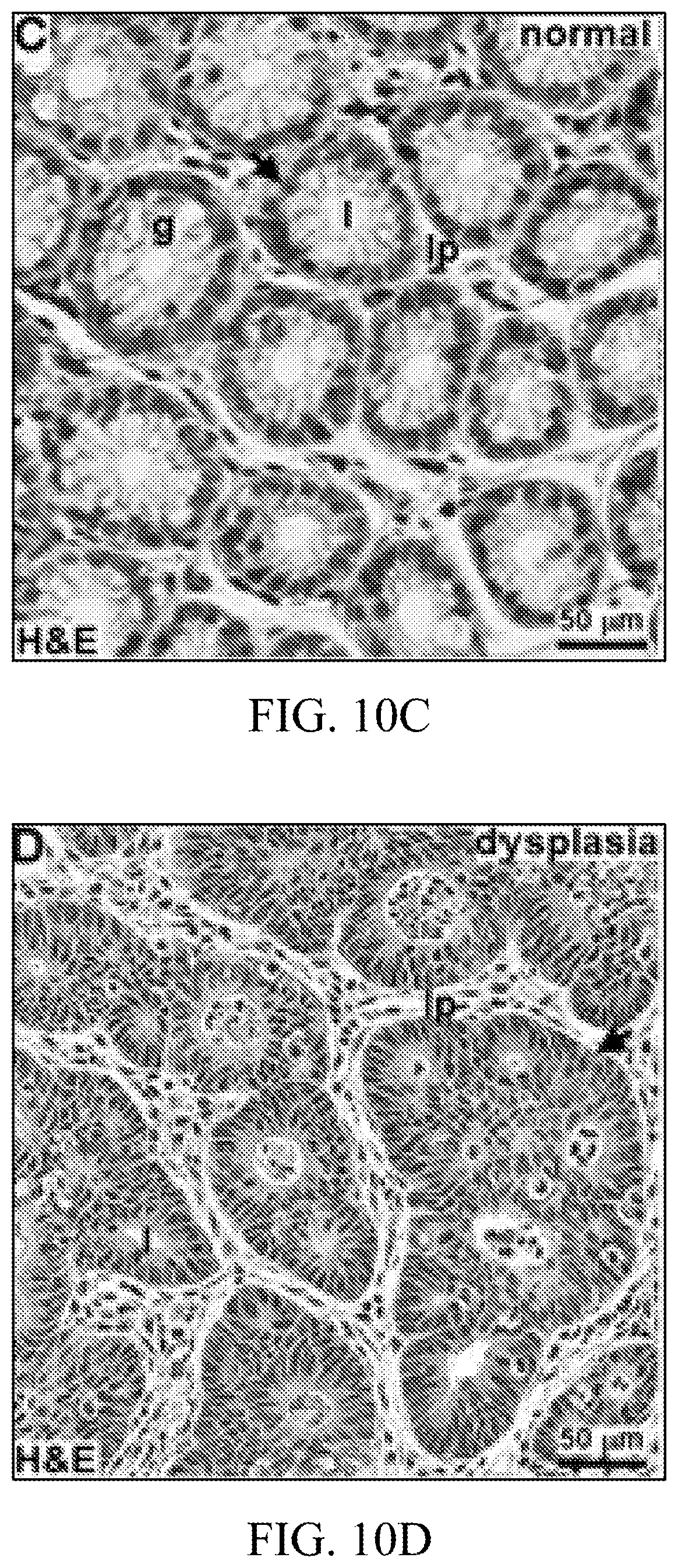 Patent US12396625 Figure 14 – Ultra-compact microsystems-based single axis confocal endomicroscope