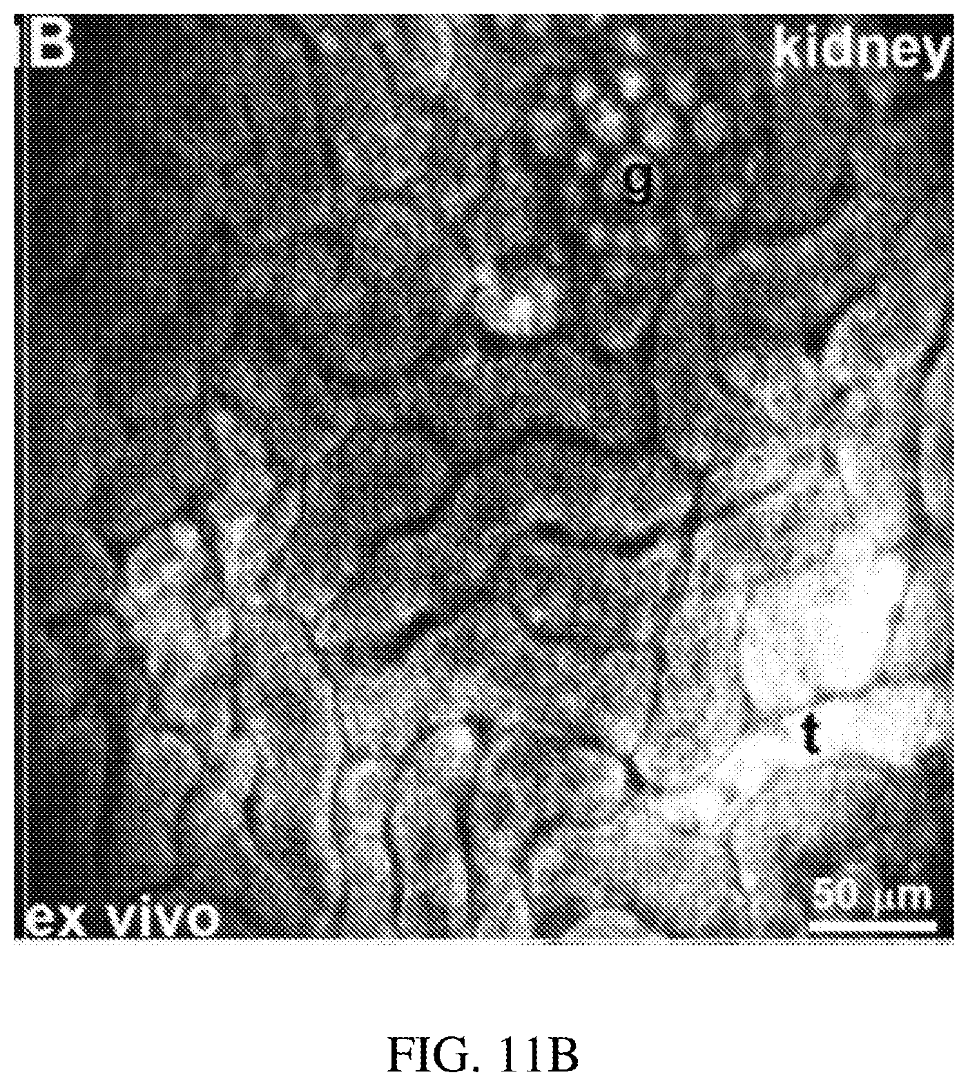 Patent US12396625 Figure 16 – Ultra-compact microsystems-based single axis confocal endomicroscope
