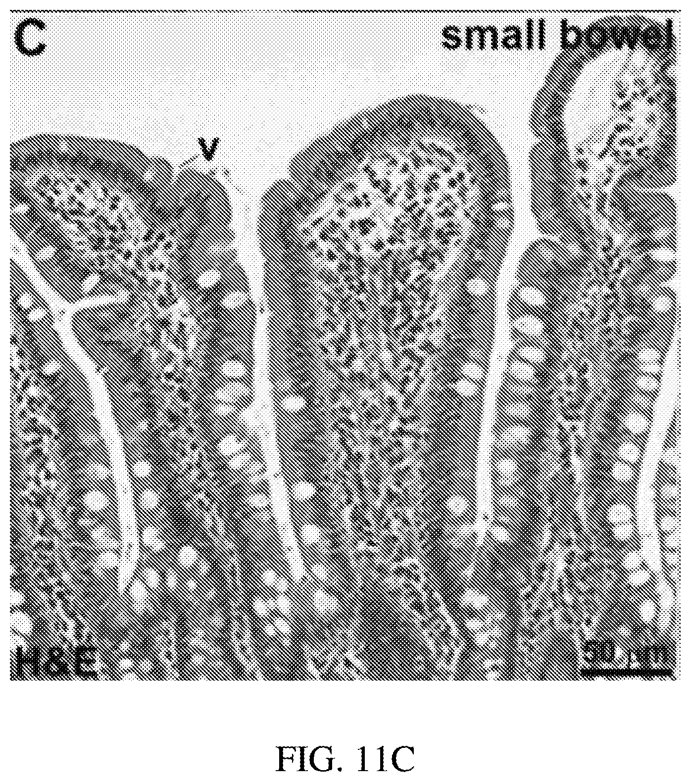 Patent US12396625 Figure 17 – Ultra-compact microsystems-based single axis confocal endomicroscope