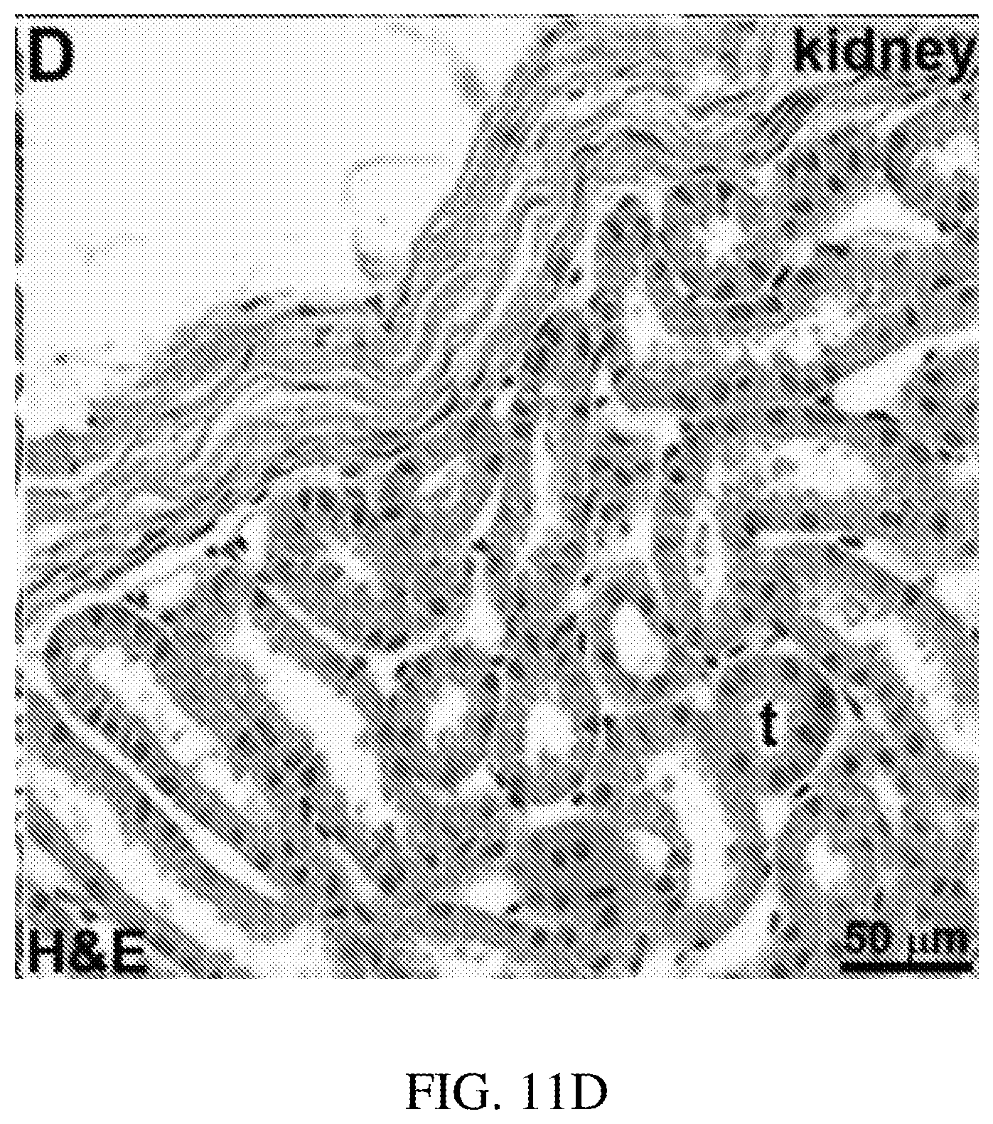 Patent US12396625 Figure 18 – Ultra-compact microsystems-based single axis confocal endomicroscope