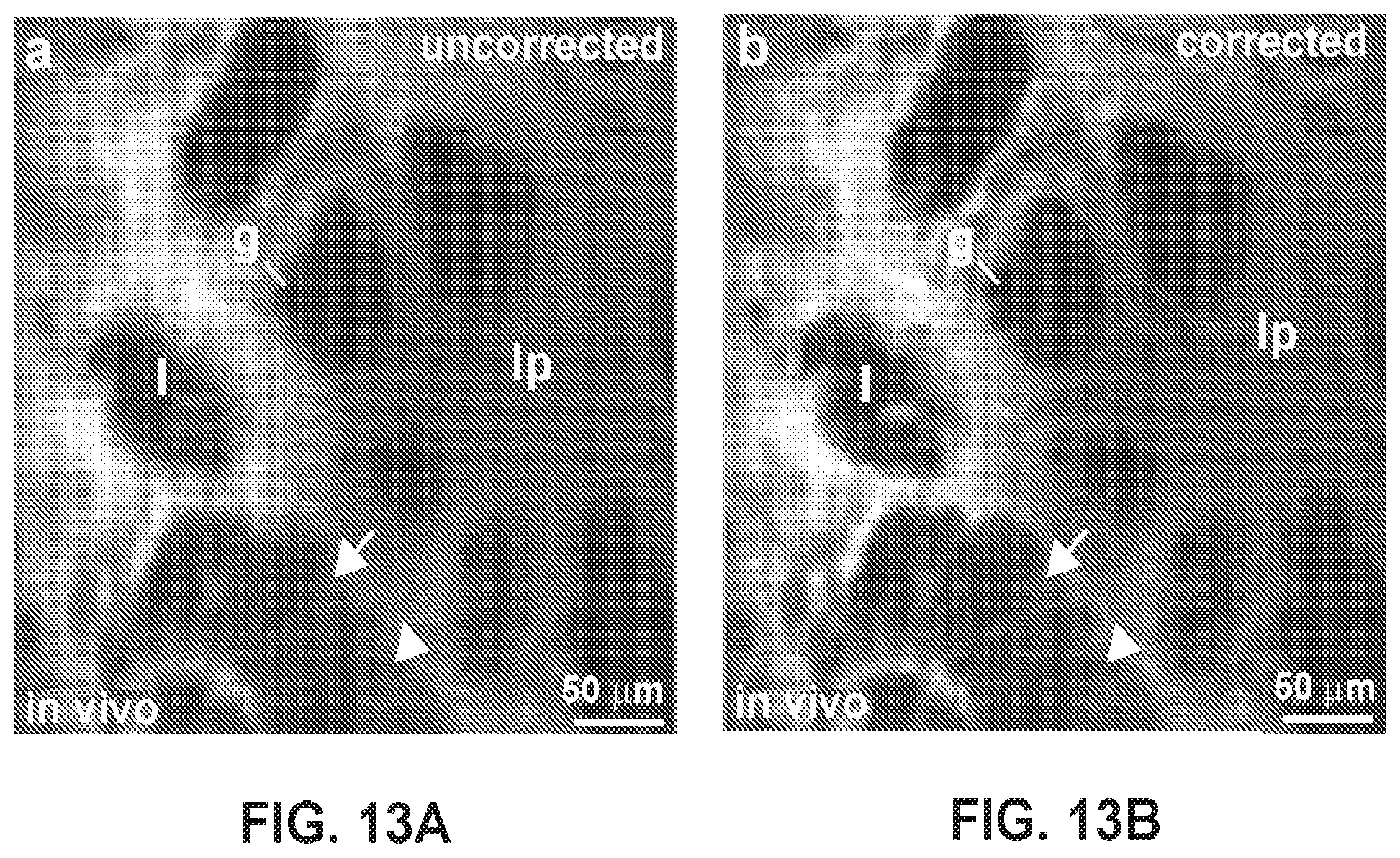 Patent US12396625 Figure 20 – Ultra-compact microsystems-based single axis confocal endomicroscope