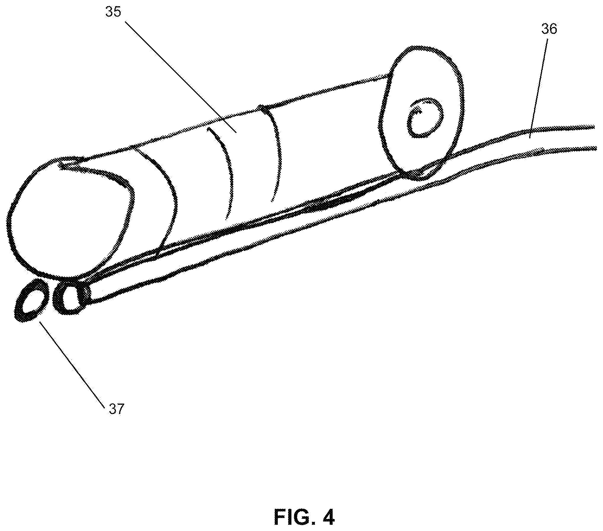 Patent US12396632 Figure 3 – Enhanced visualization methods and systems for endoscopic procedures