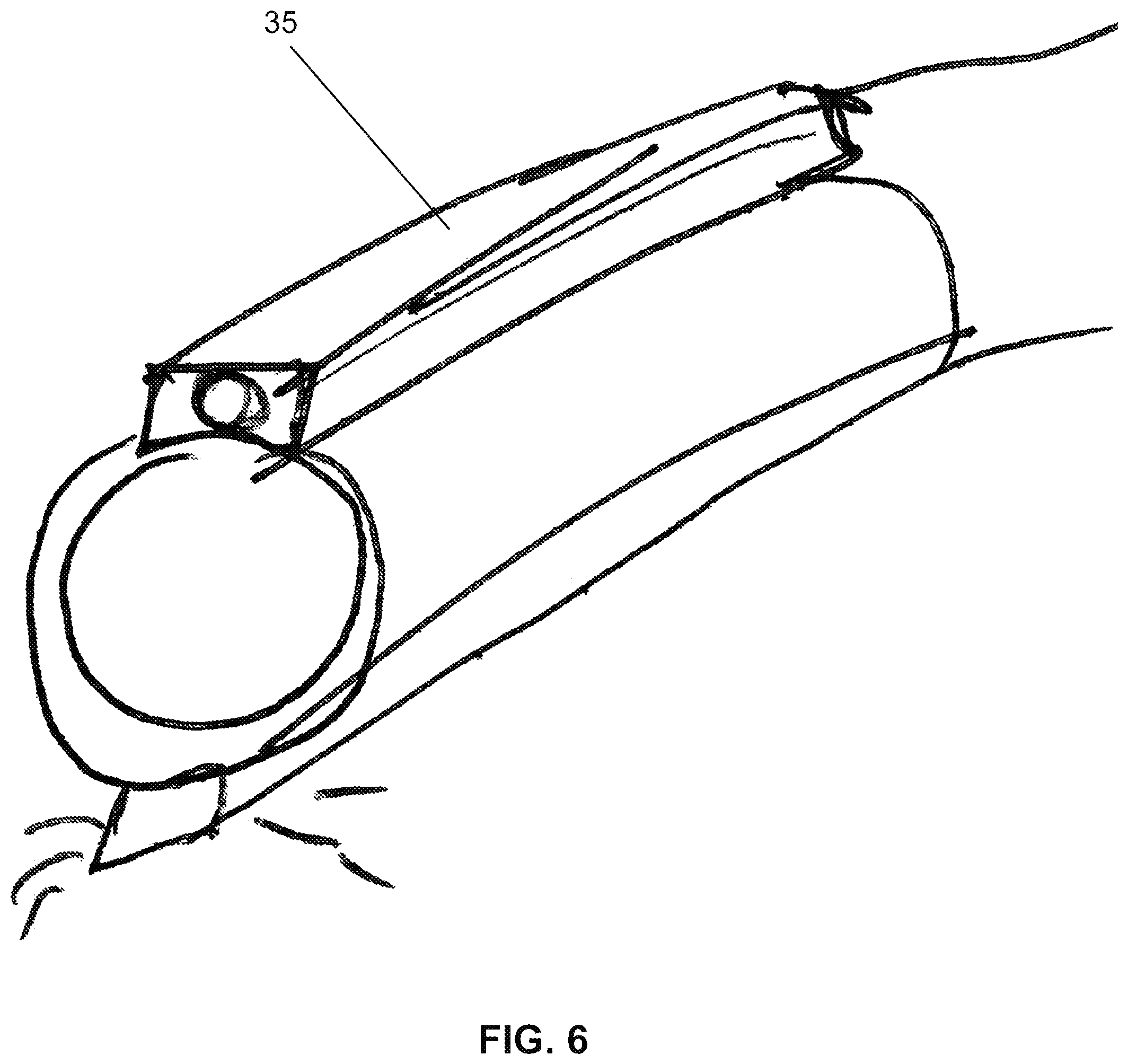 Patent US12396632 Figure 5 – Enhanced visualization methods and systems for endoscopic procedures