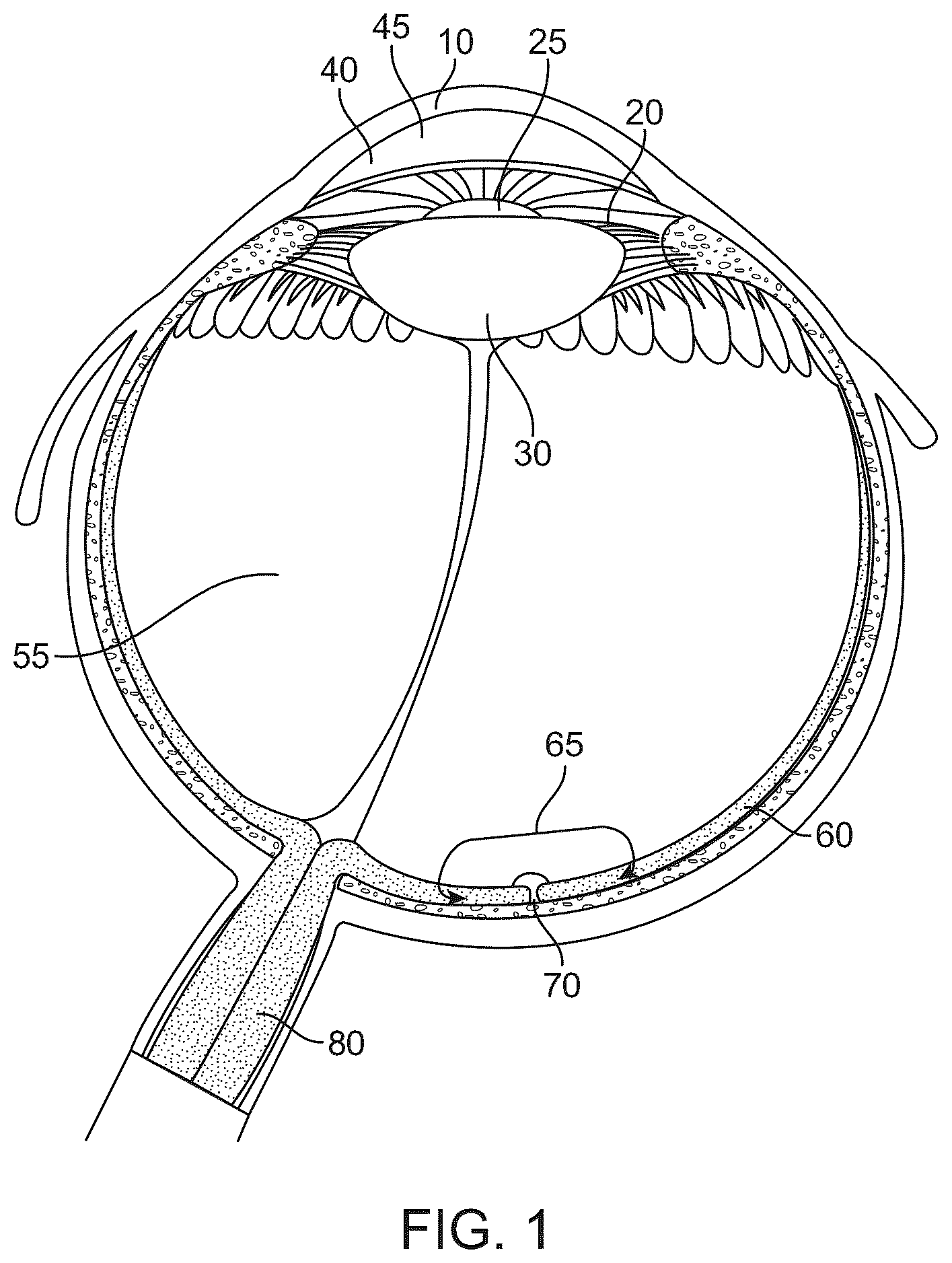 Patent US12396639 — Miniaturized mobile, low cost optical coherence tomography system for home based ophthalmic applications — Figure 1