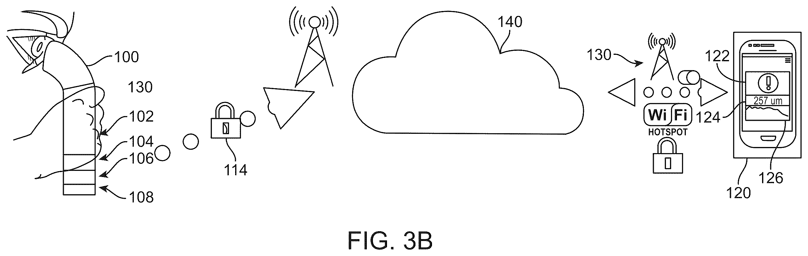 Patent US12396639 Figure 4 – Miniaturized mobile, low cost optical coherence tomography system for home based ophthalmic applications