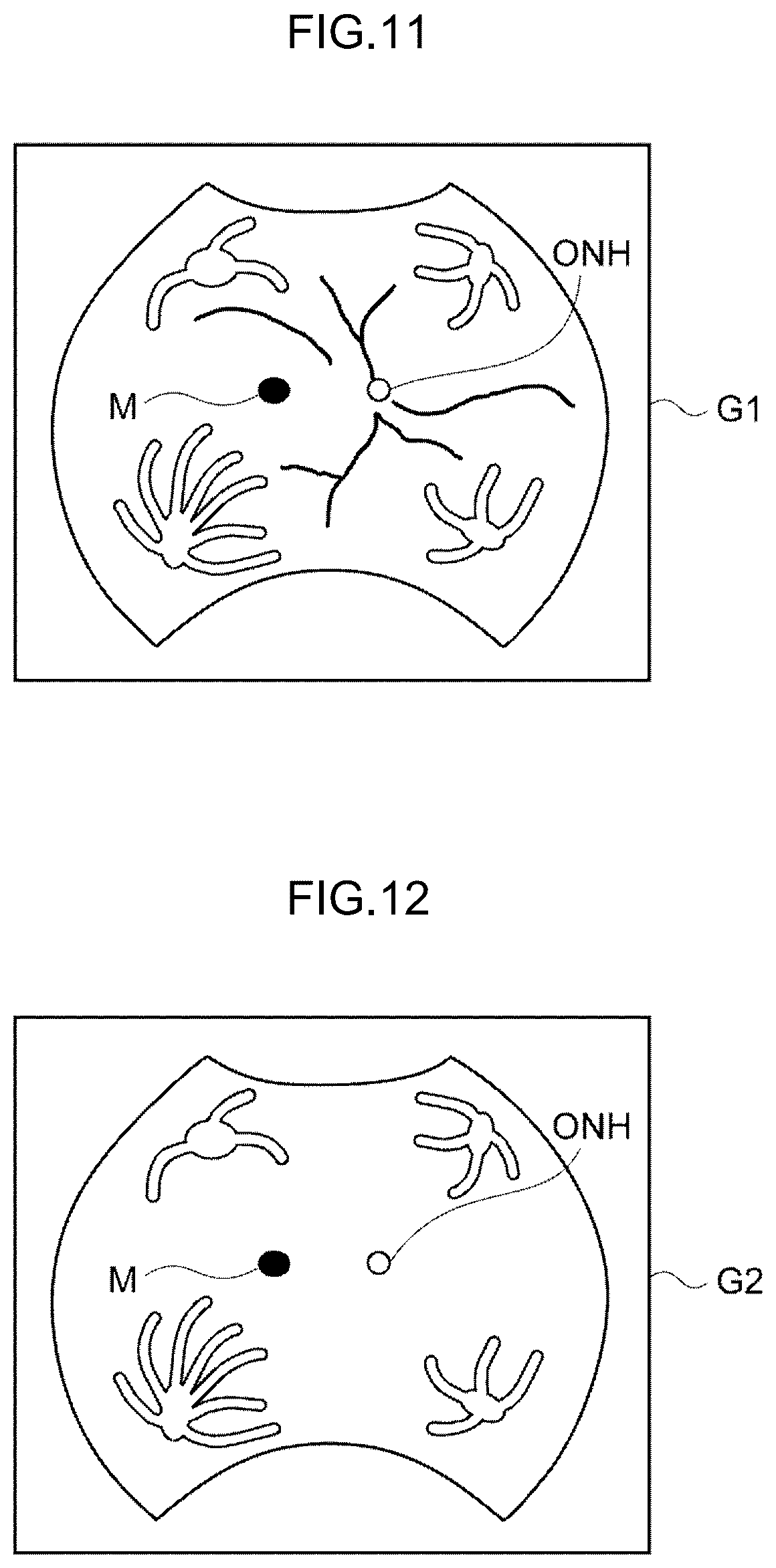 Patent US12396642 Figure 10 – Image processing method, image processing device, and program