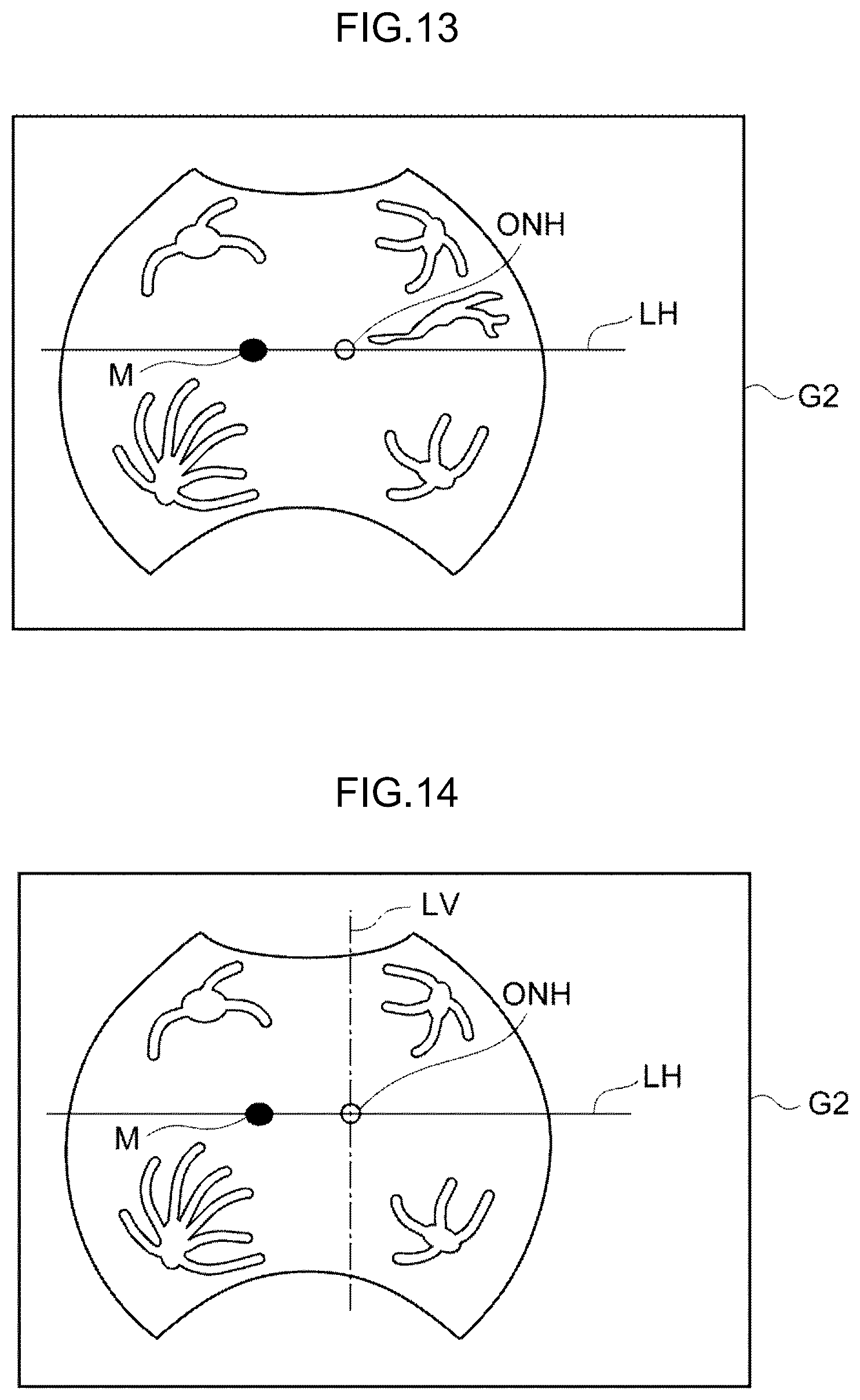 Patent US12396642 Figure 11 – Image processing method, image processing device, and program