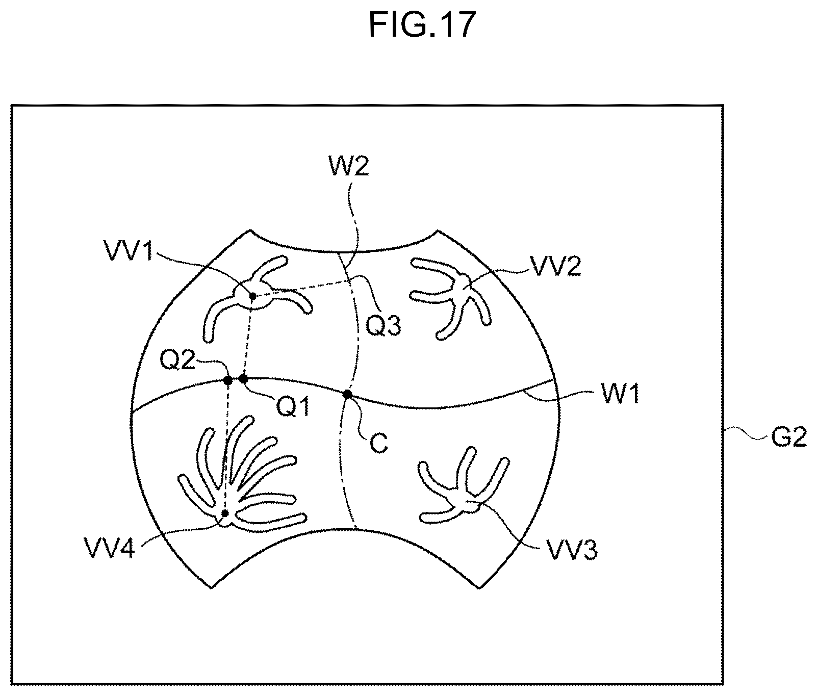 Patent US12396642 Figure 14 – Image processing method, image processing device, and program
