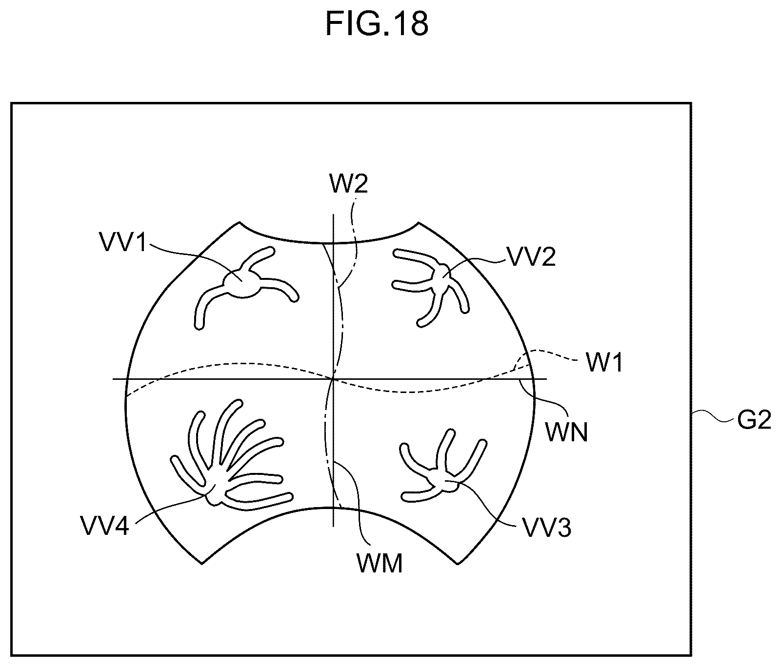 Patent US12396642 Figure 15 – Image processing method, image processing device, and program