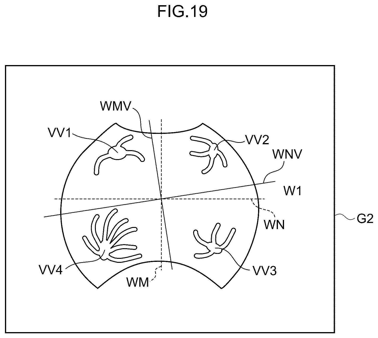 Patent US12396642 Figure 16 – Image processing method, image processing device, and program