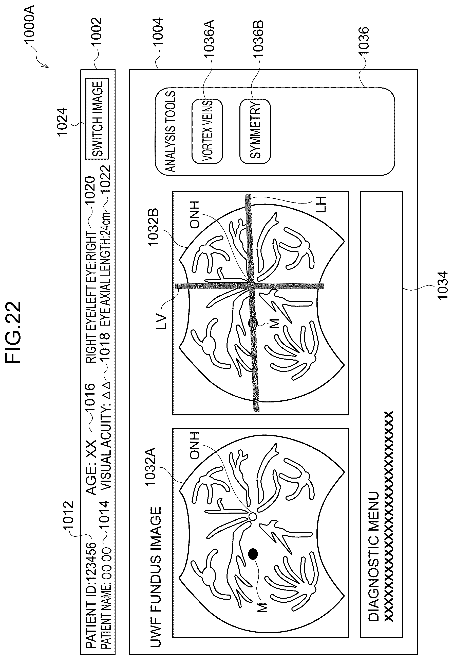 Patent US12396642 Figure 19 – Image processing method, image processing device, and program