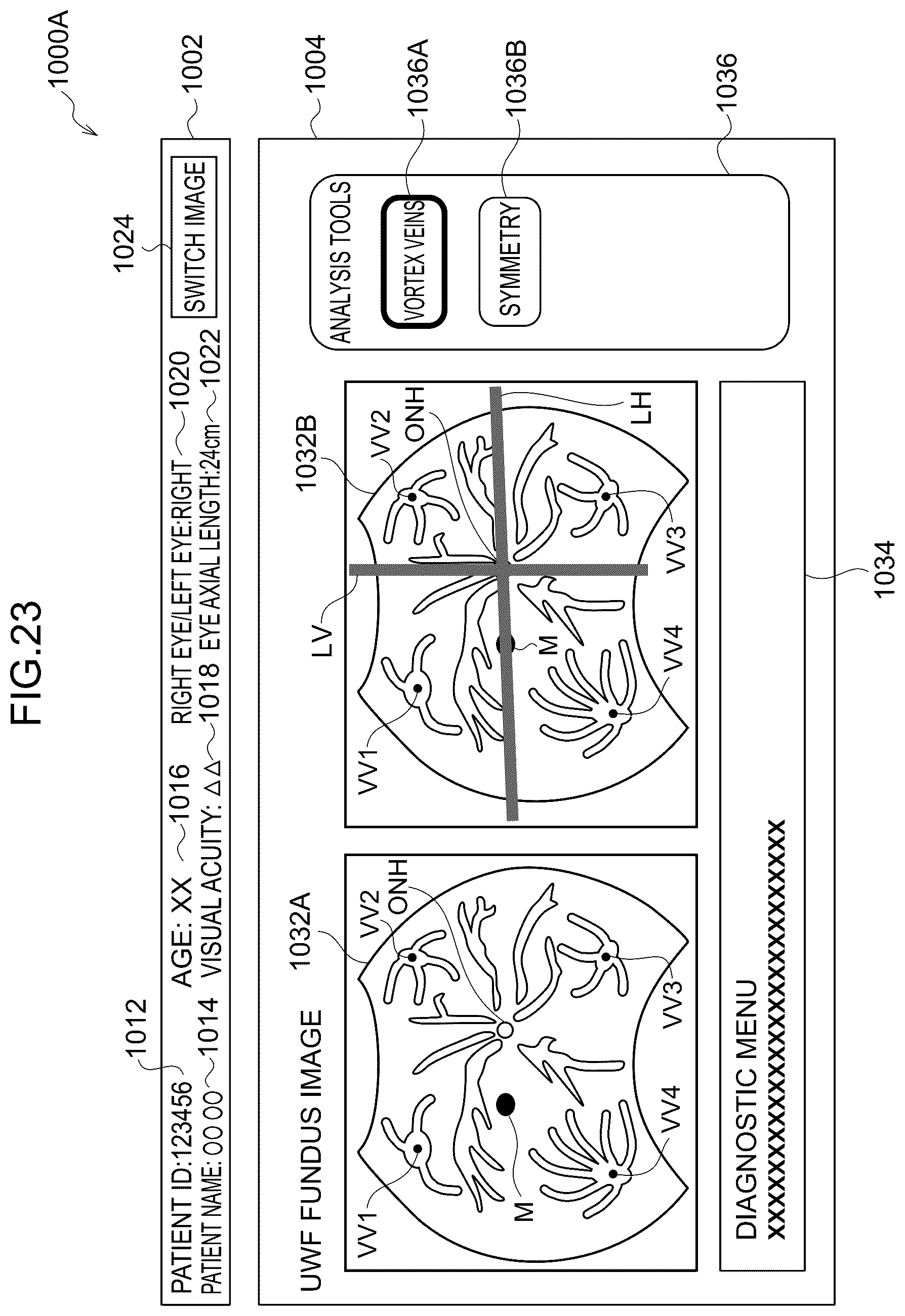 Patent US12396642 Figure 20 – Image processing method, image processing device, and program