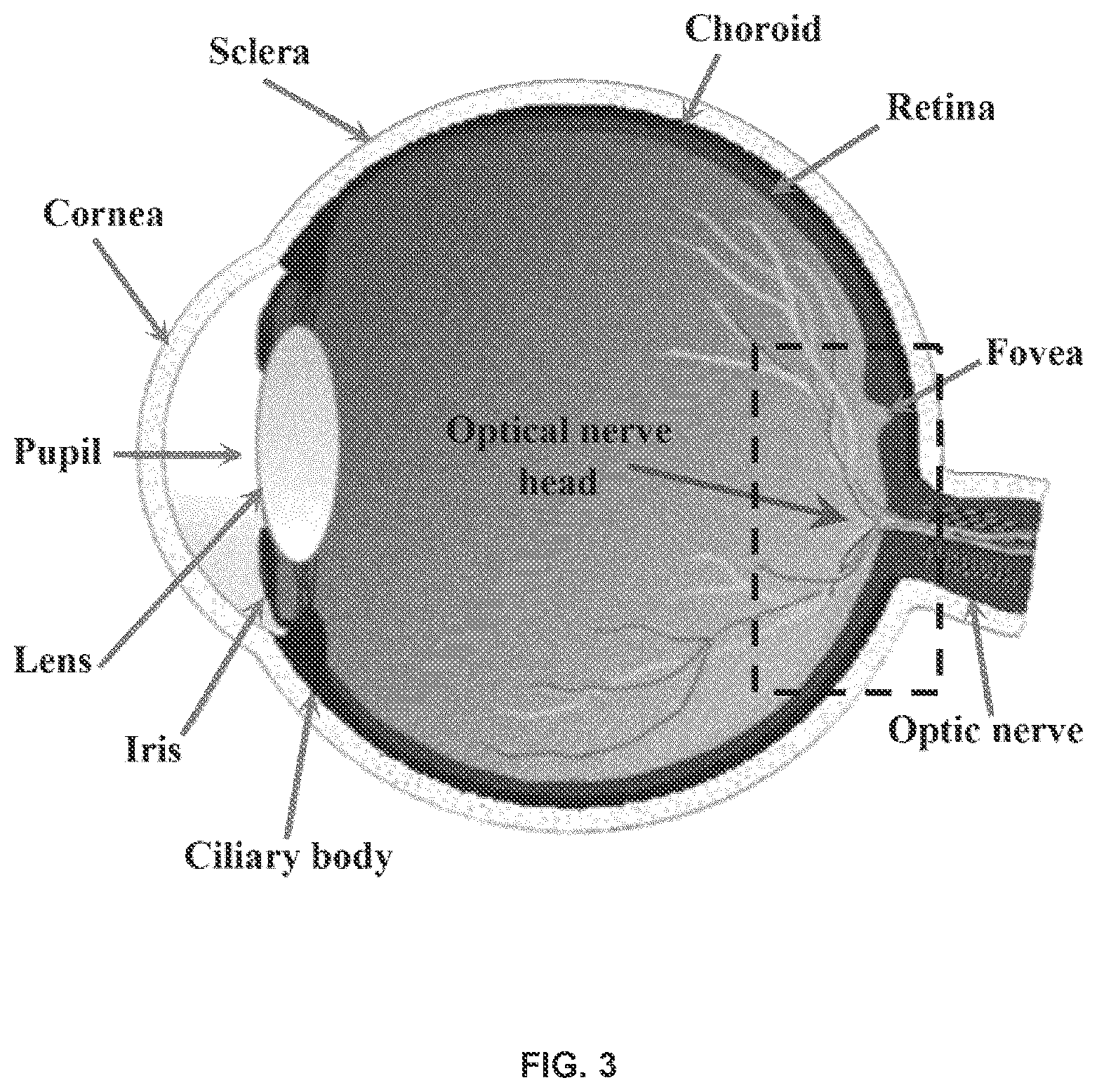 Patent US12396643 Figure 4 – Systems and methods for performing Gabor optical coherence tomographic angiography
