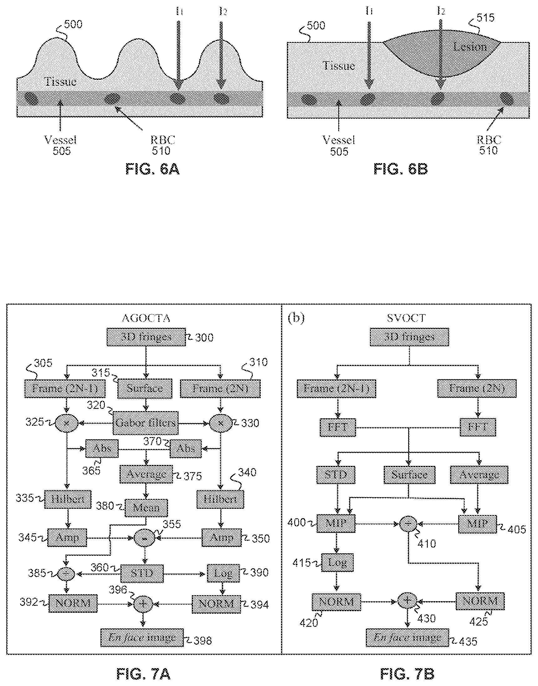 Patent US12396643 Figure 6 – Systems and methods for performing Gabor optical coherence tomographic angiography