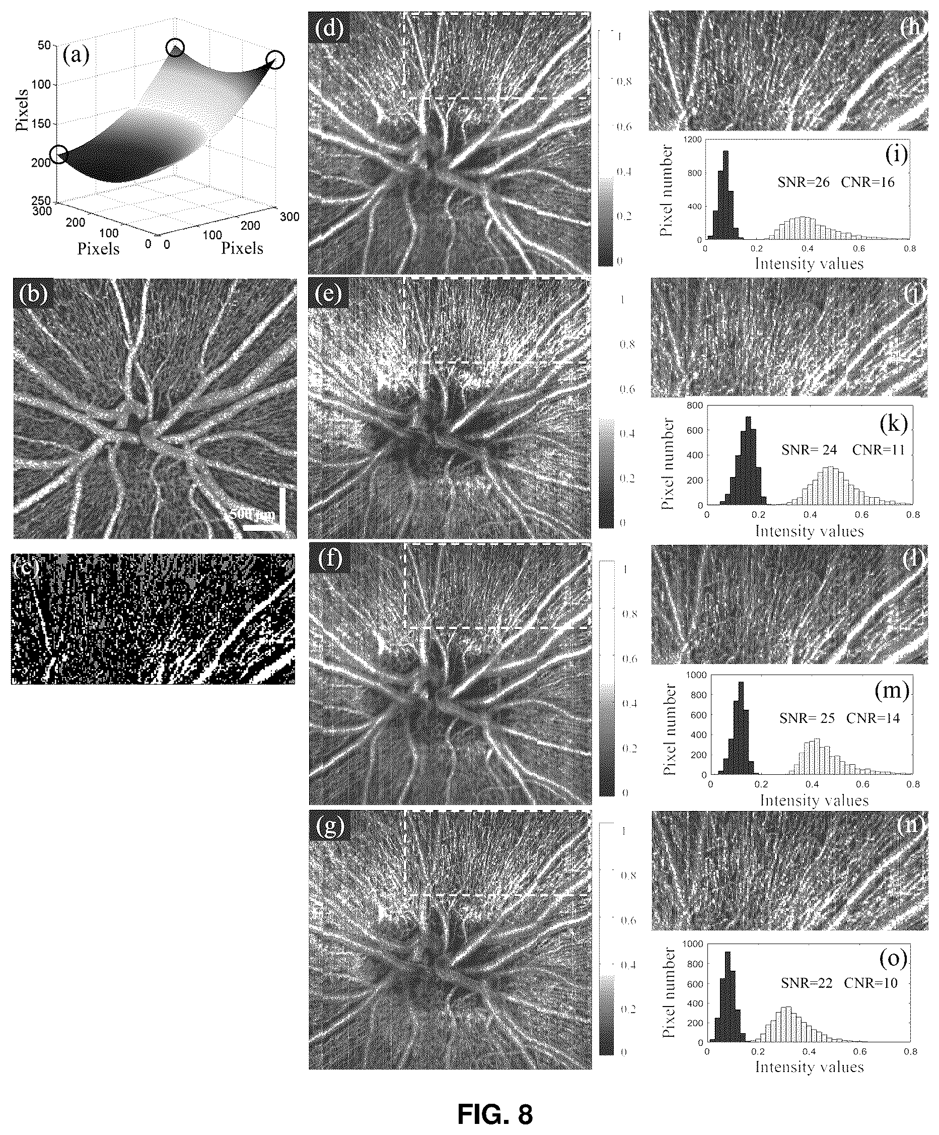 Patent US12396643 Figure 7 – Systems and methods for performing Gabor optical coherence tomographic angiography