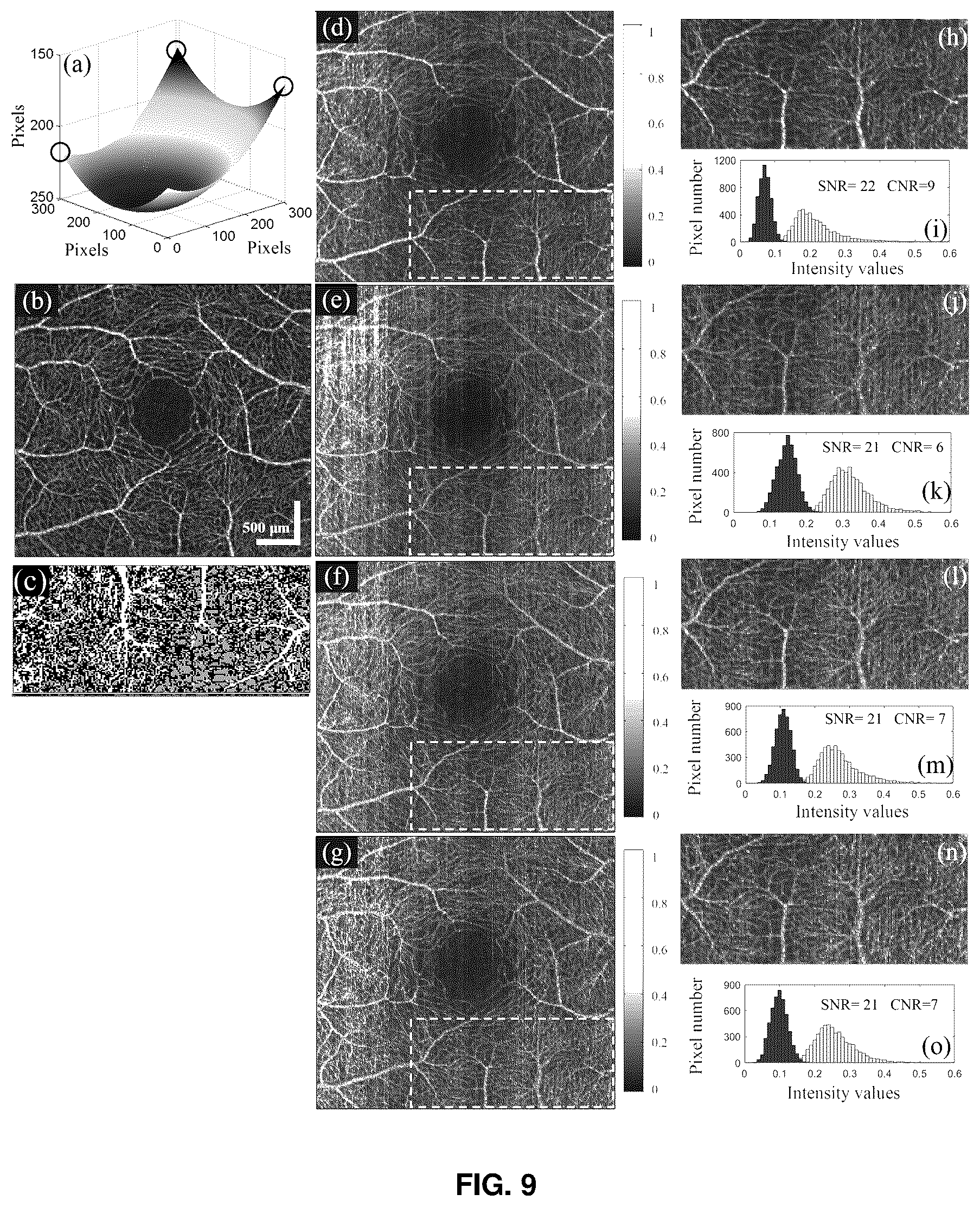 Patent US12396643 Figure 8 – Systems and methods for performing Gabor optical coherence tomographic angiography