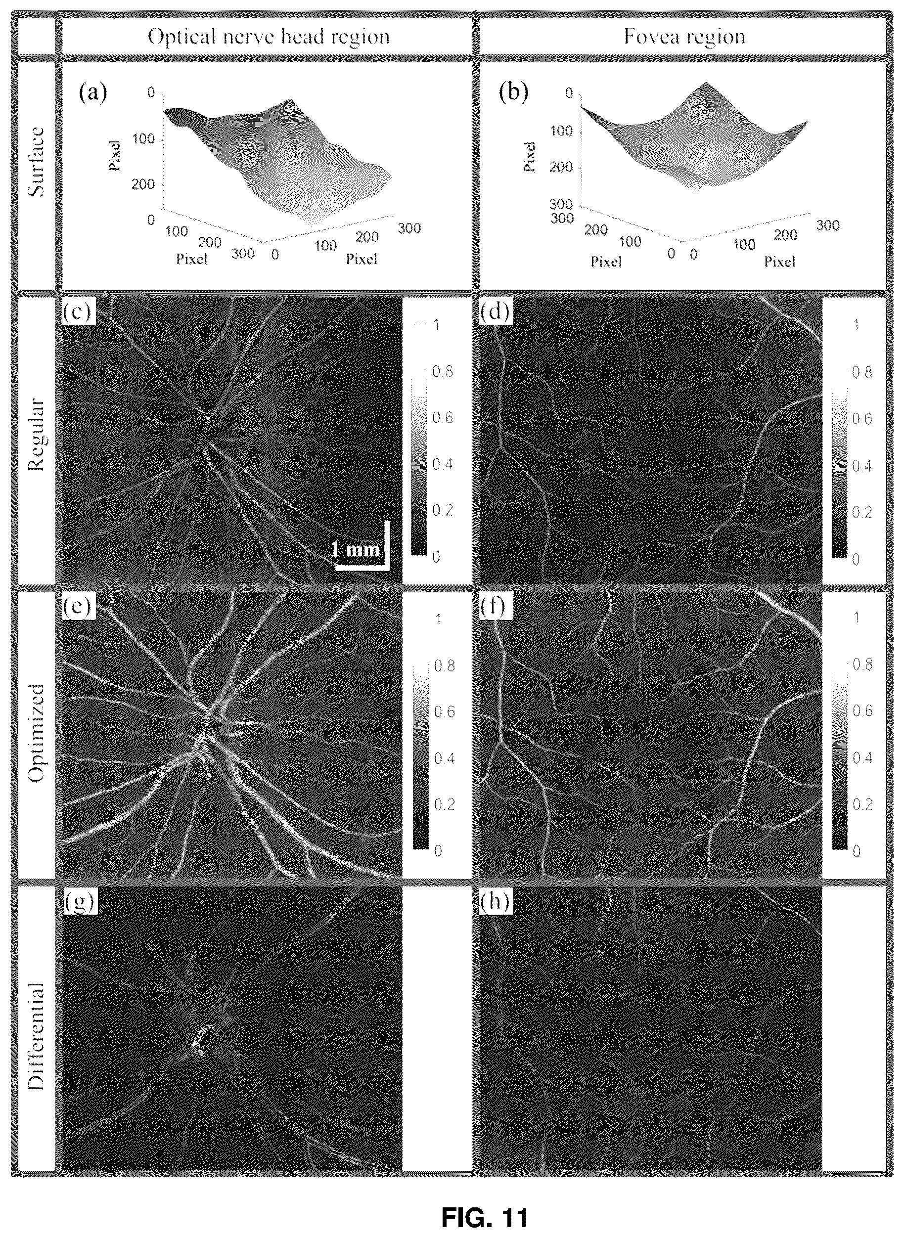 Patent US12396643 Figure 10 – Systems and methods for performing Gabor optical coherence tomographic angiography