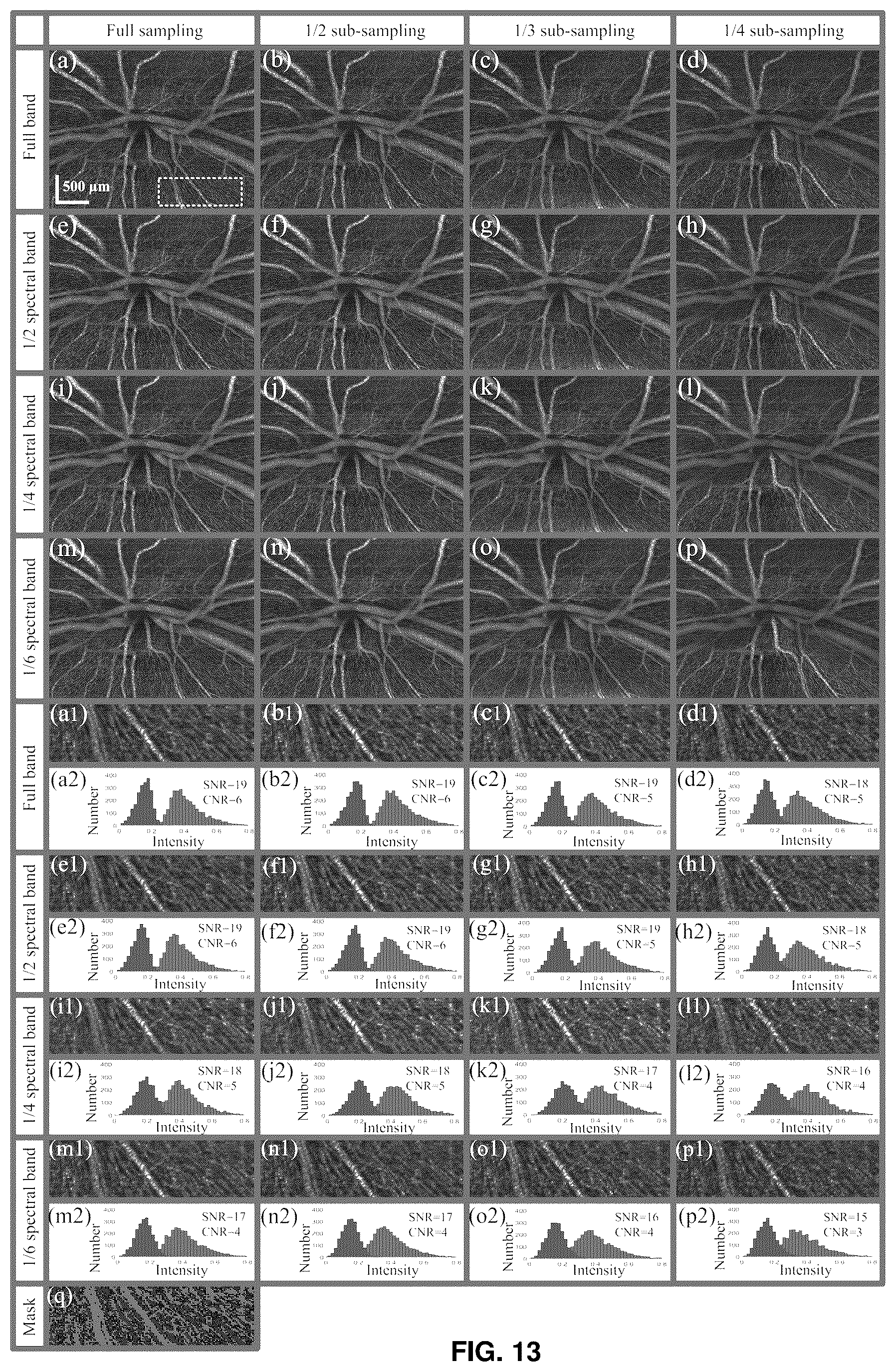 Patent US12396643 Figure 12 – Systems and methods for performing Gabor optical coherence tomographic angiography