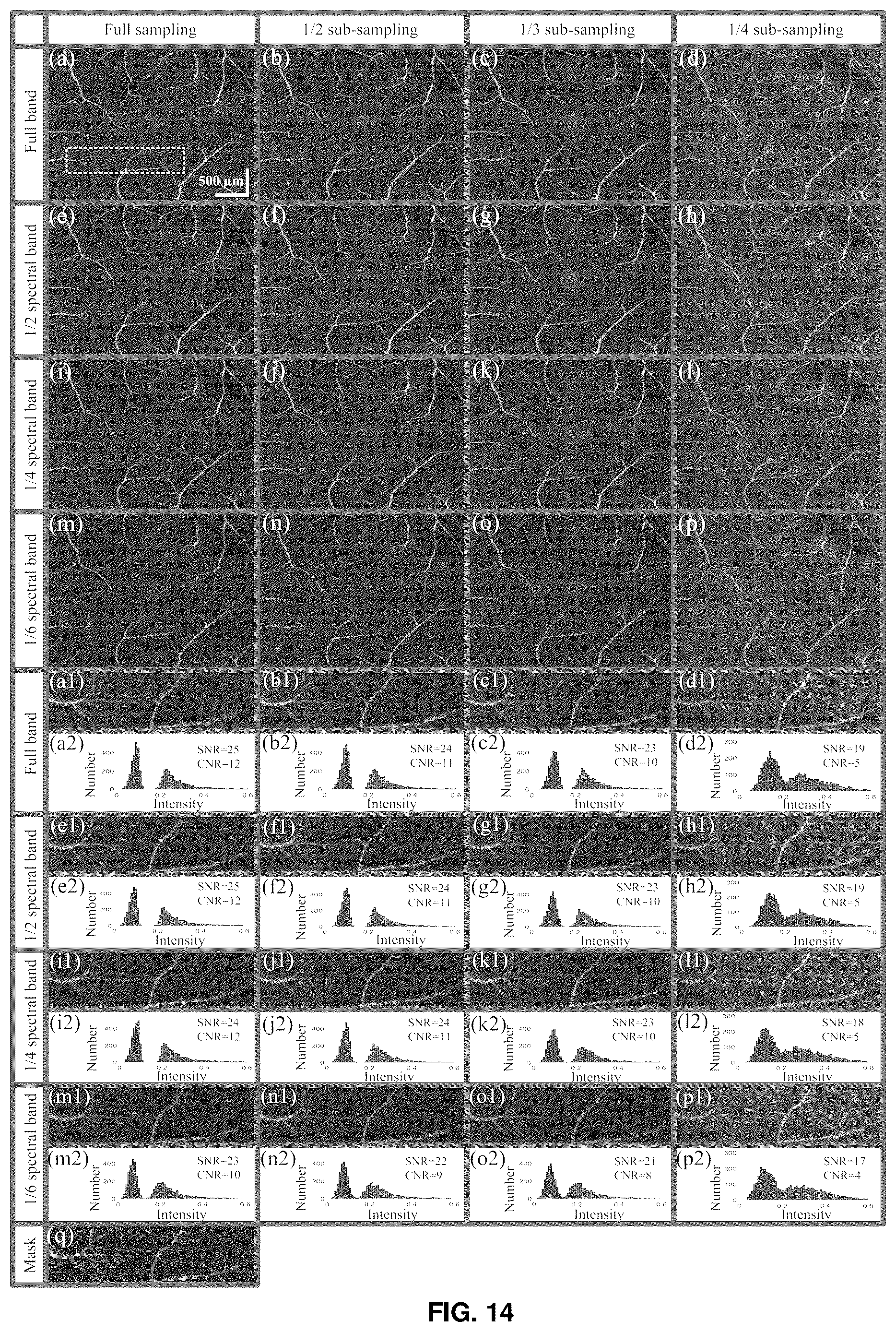 Patent US12396643 Figure 13 – Systems and methods for performing Gabor optical coherence tomographic angiography