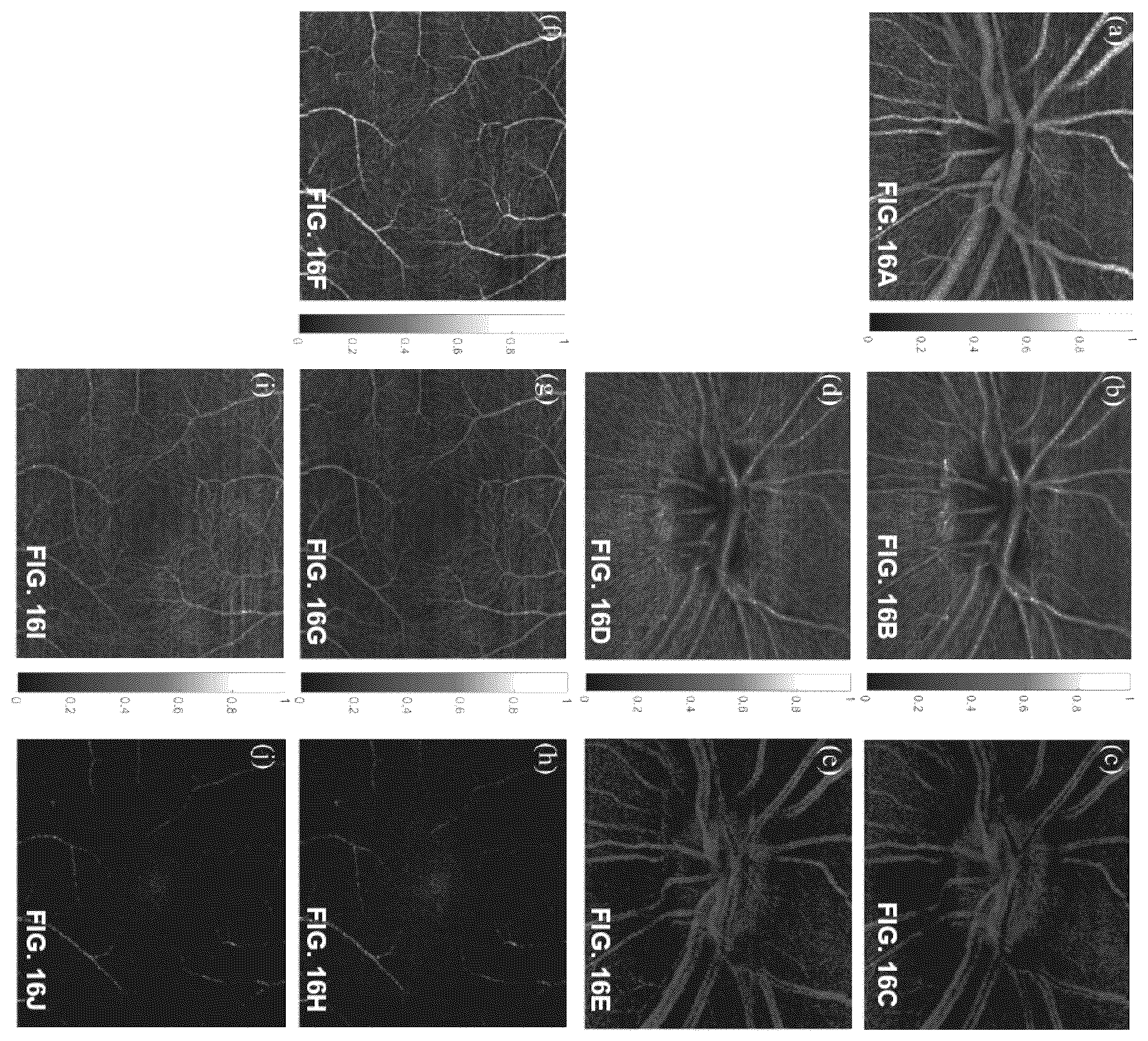 Patent US12396643 Figure 15 – Systems and methods for performing Gabor optical coherence tomographic angiography