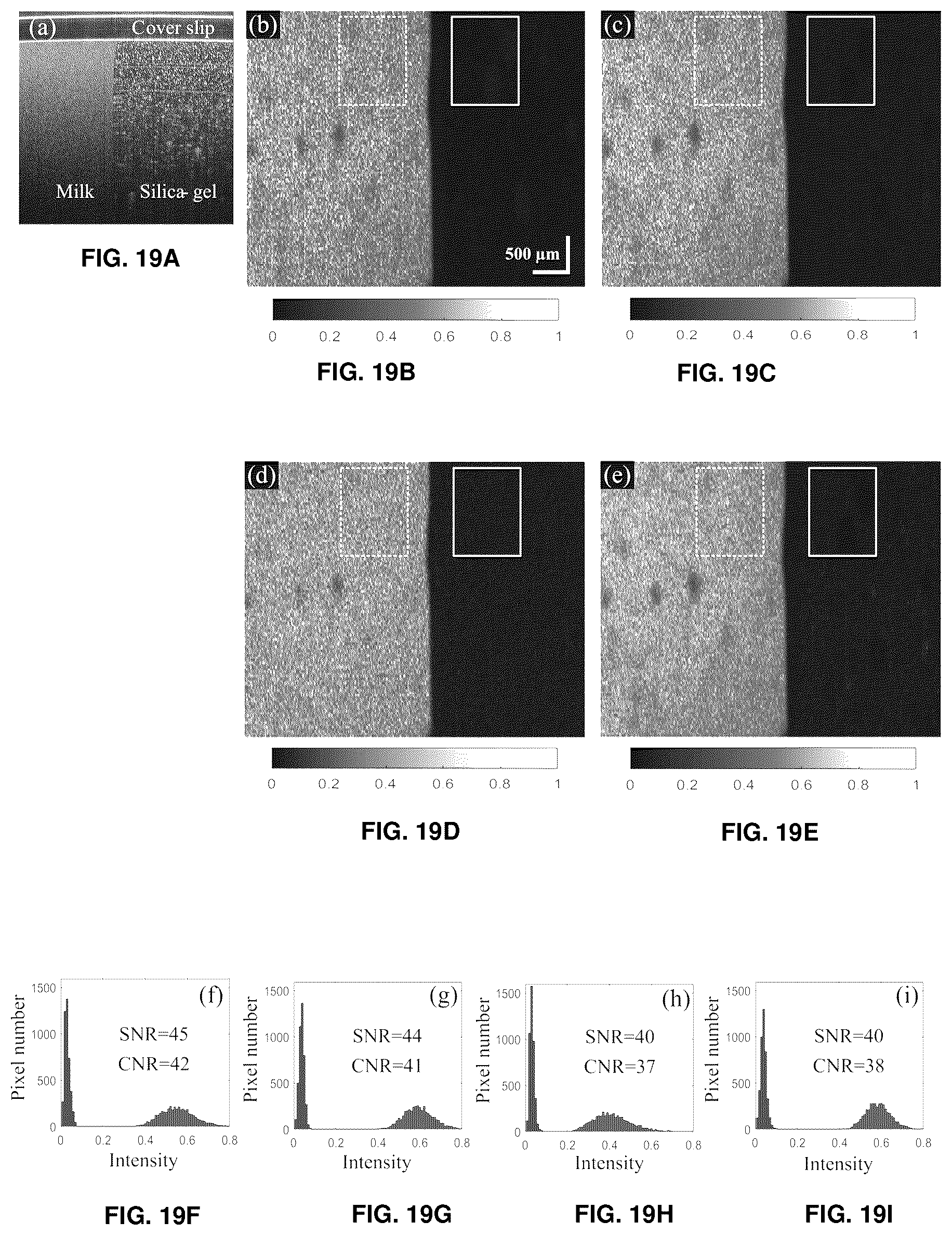 Patent US12396643 Figure 18 – Systems and methods for performing Gabor optical coherence tomographic angiography