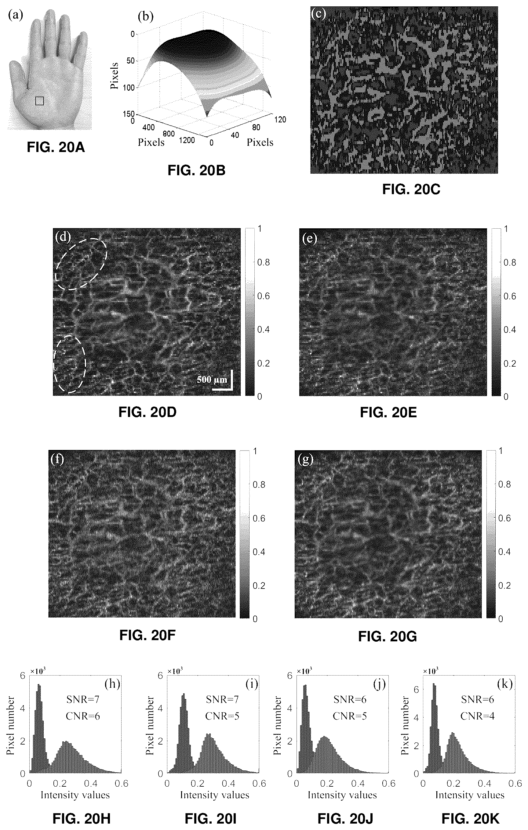 Patent US12396643 Figure 19 – Systems and methods for performing Gabor optical coherence tomographic angiography