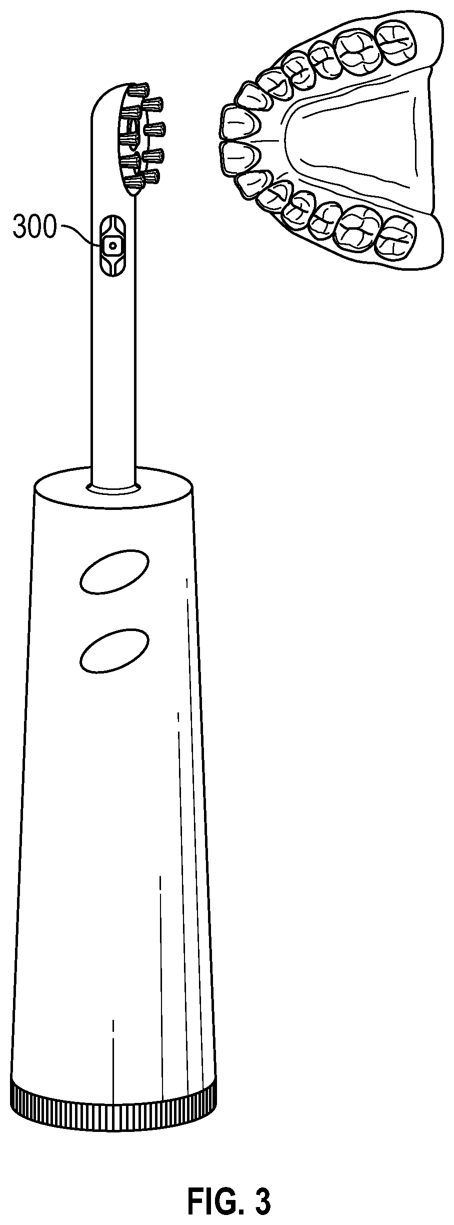 Patent US12396647 Figure 3 – Spectrographic tooth evaluation system