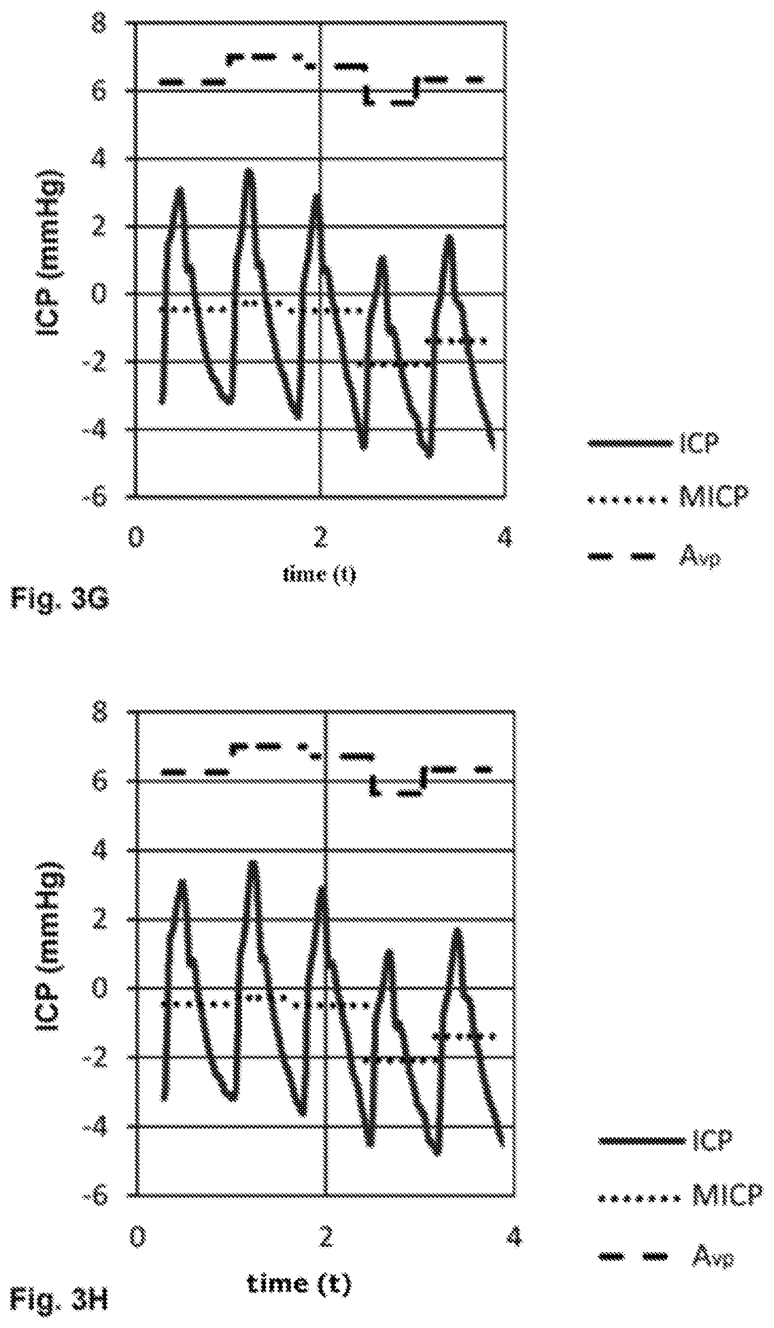 Patent US12396649 Figure 6 – Device for determining a parameter for diagnosing hydrocephalus and other disorders of intracranial pressure