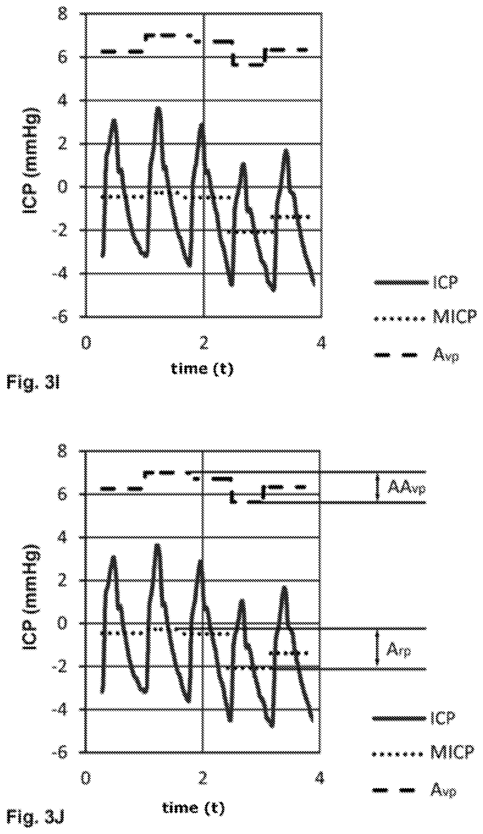 Patent US12396649 Figure 7 – Device for determining a parameter for diagnosing hydrocephalus and other disorders of intracranial pressure