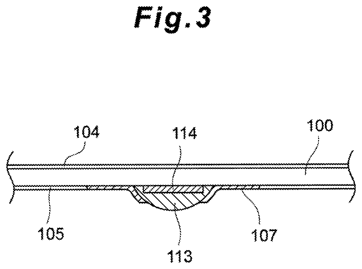Patent US12396650 Figure 4 – Subdural sensor