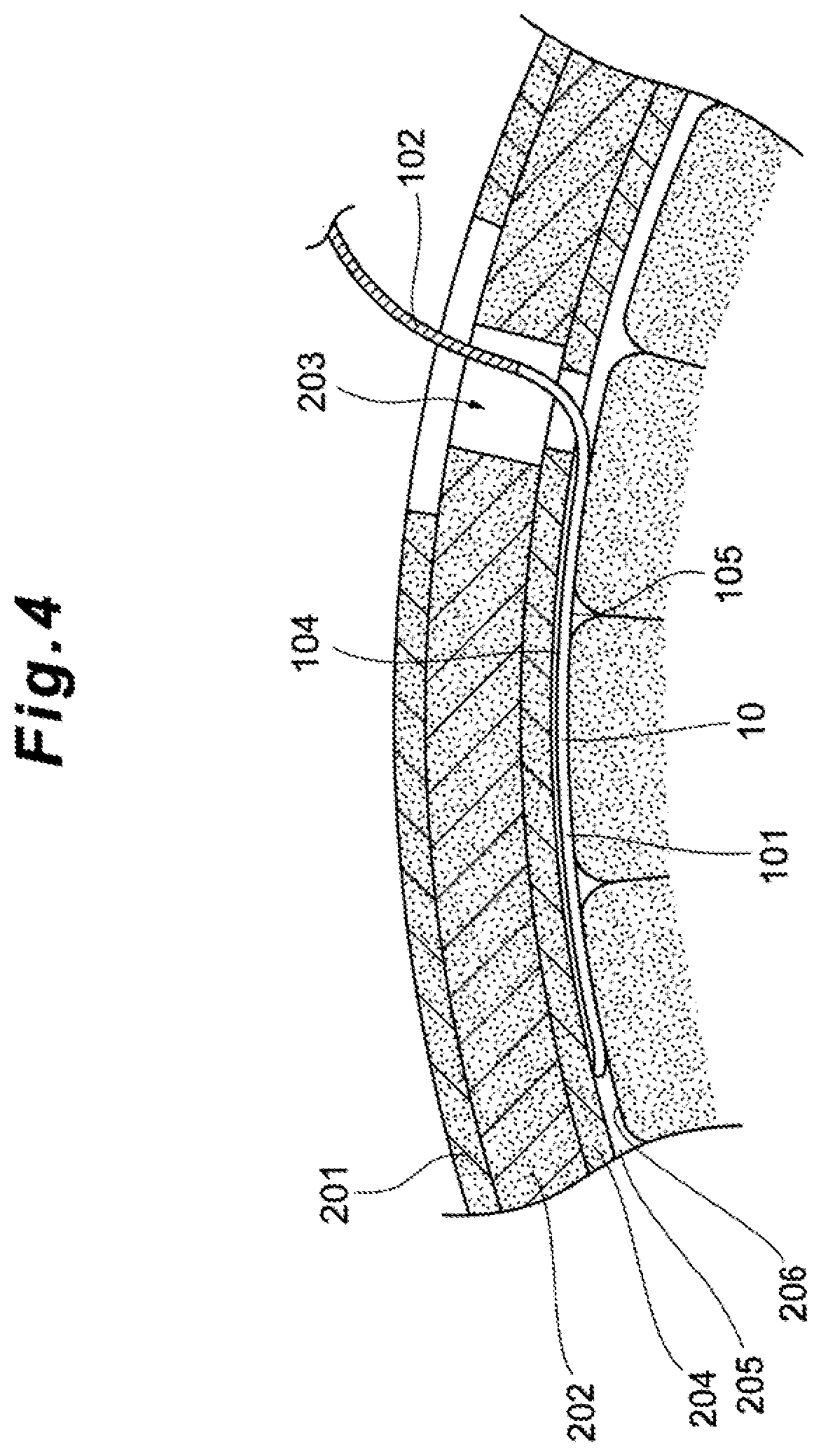 Patent US12396650 Figure 5 – Subdural sensor