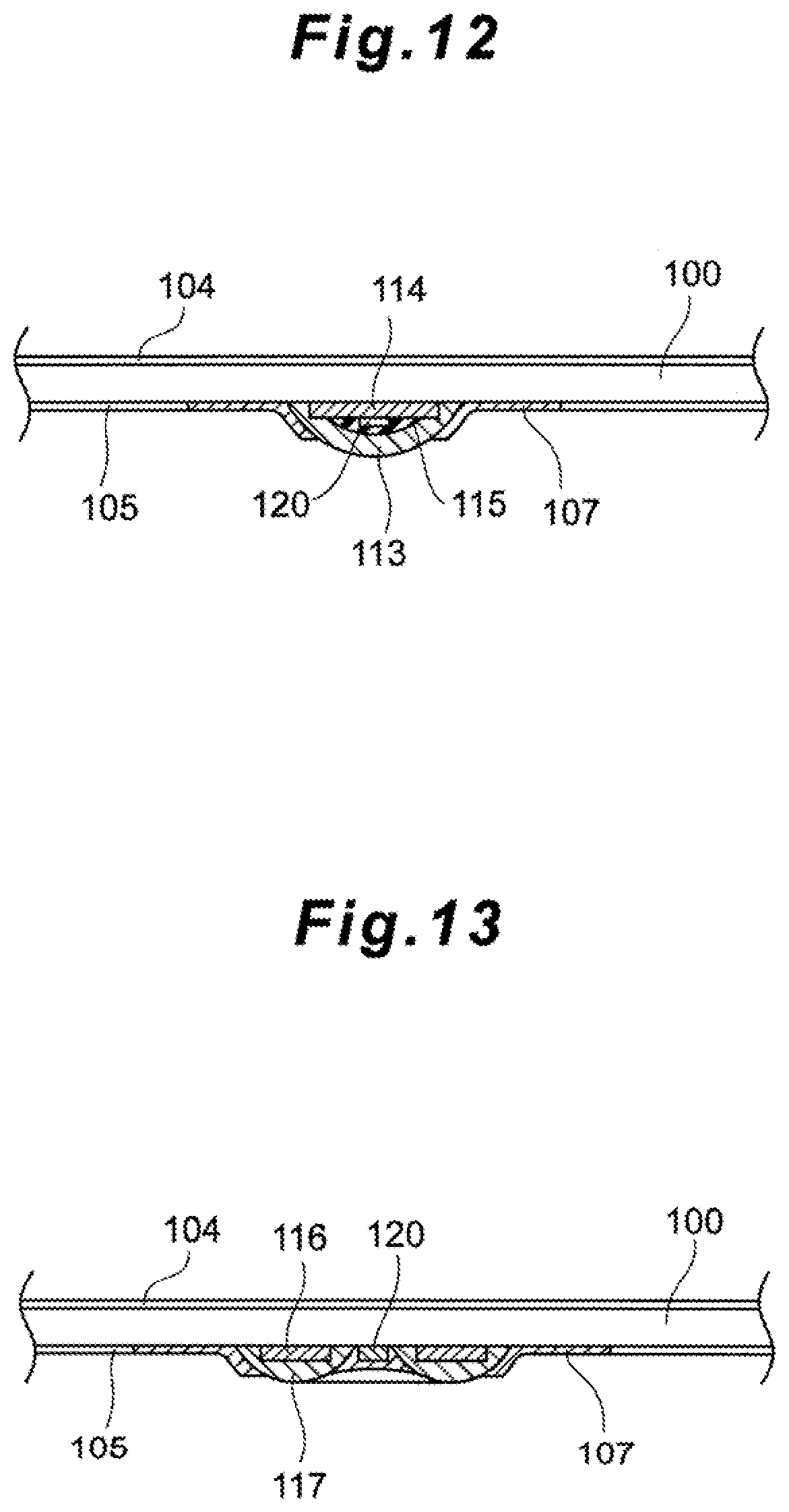 Patent US12396650 Figure 12 – Subdural sensor