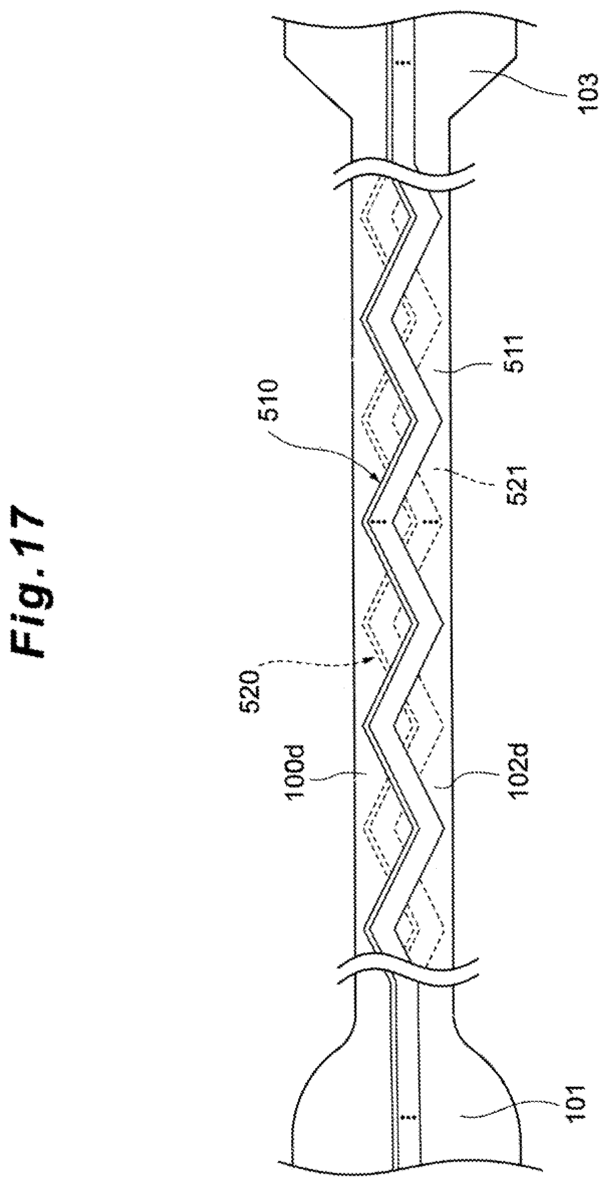 Patent US12396650 Figure 16 – Subdural sensor