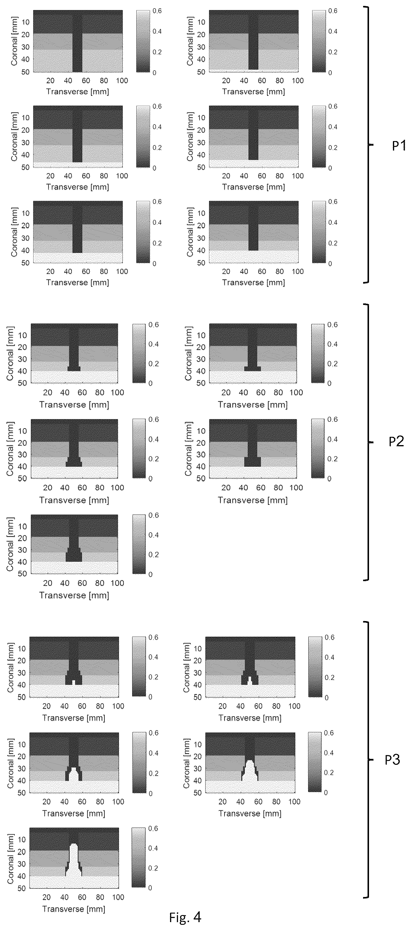 Patent US12396651 Figure 3 – System and method for detecting changes in human tissues