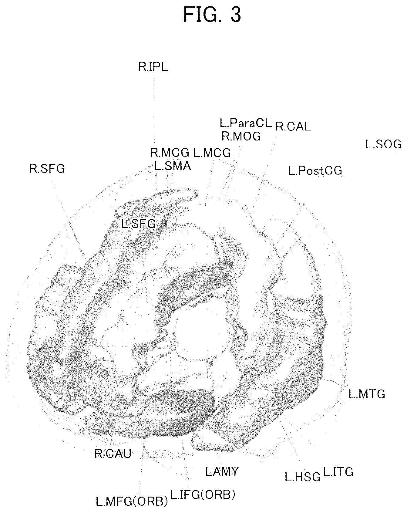 Patent US12396652 Figure 3 – Brain activity analyzing apparatus, brain activity analyzing method and biomarker apparatus