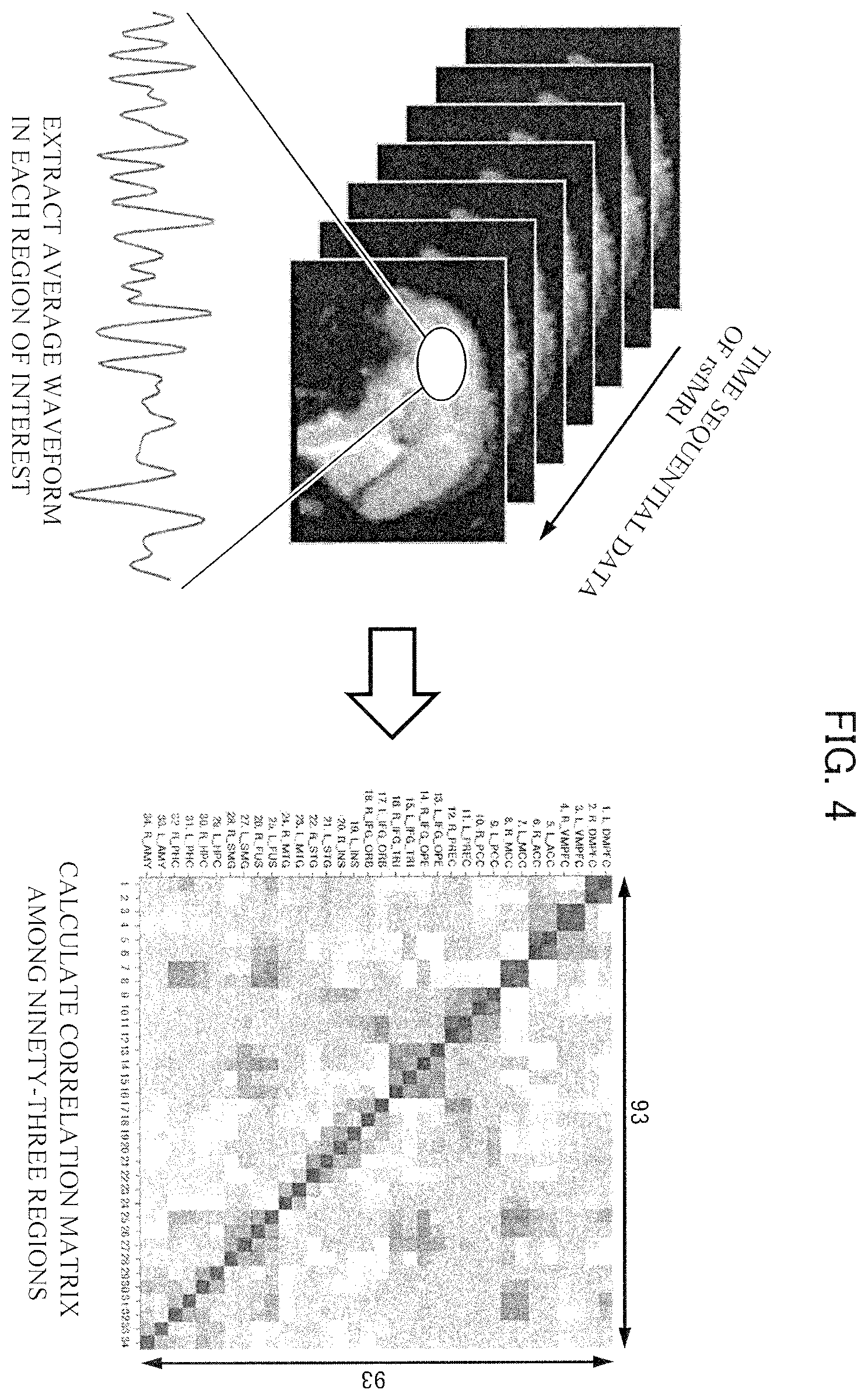 Patent US12396652 Figure 4 – Brain activity analyzing apparatus, brain activity analyzing method and biomarker apparatus