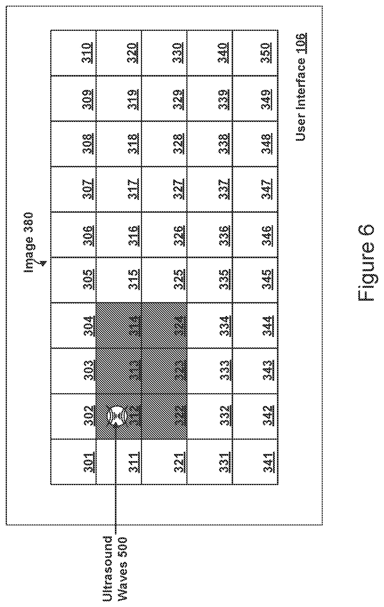Patent US12396653 Figure 6 – MRI-based feedback control of ultrasound based mechanical fractionation of biological tissue